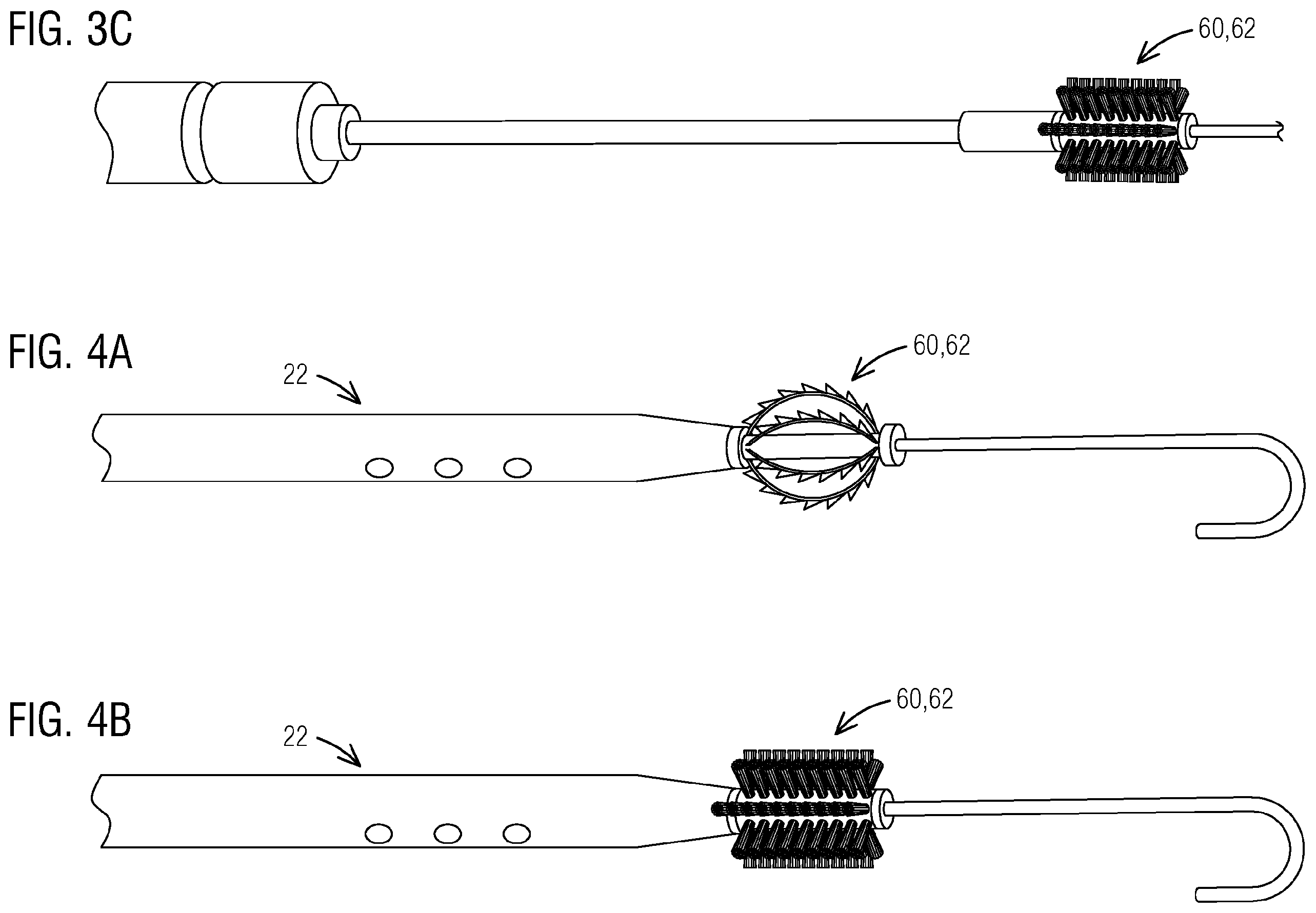 Patent US12599746 Figure 3 – Cuffed and non-cuffed dialysis catheter systems and methods