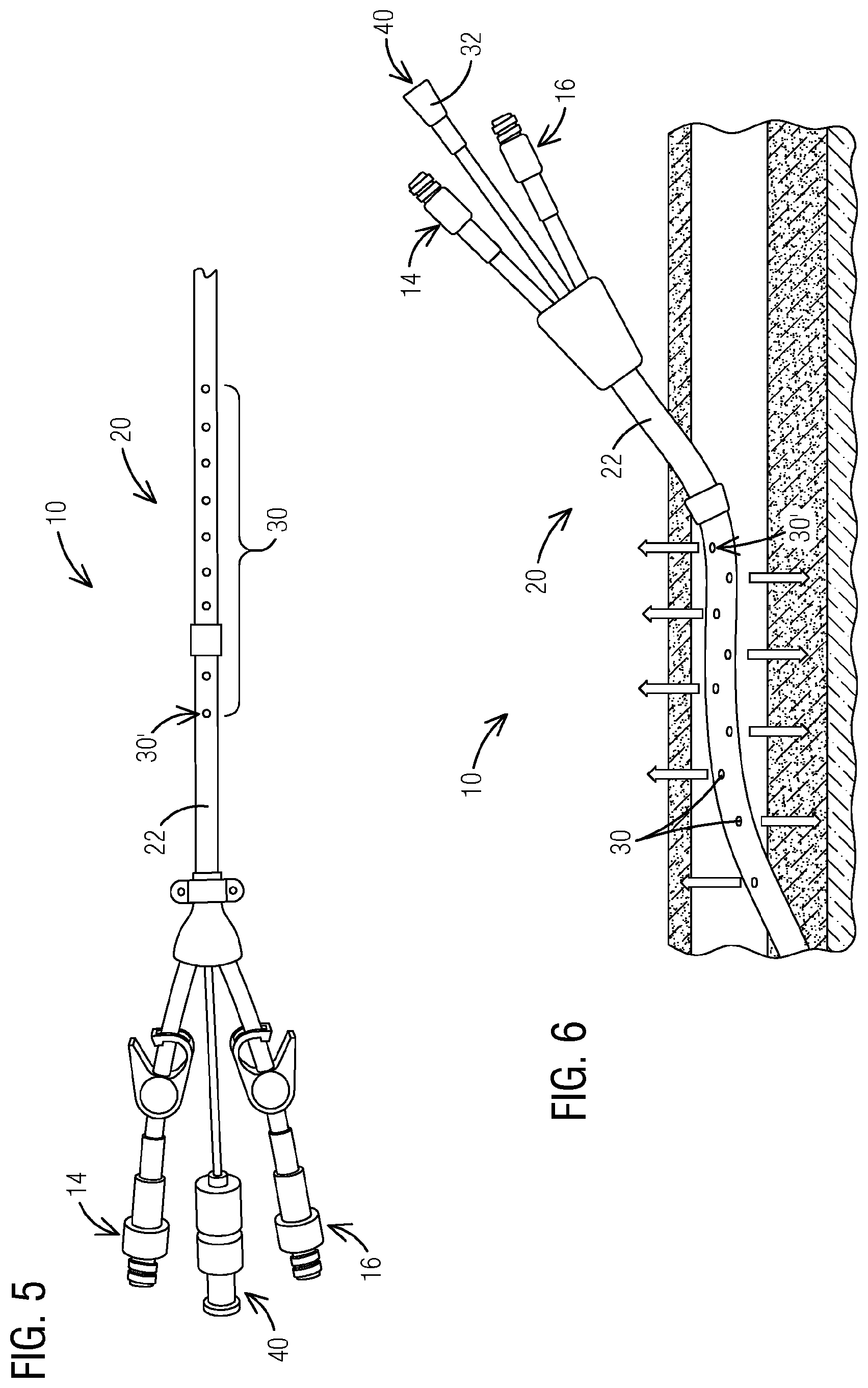 Patent US12599746 Figure 4 – Cuffed and non-cuffed dialysis catheter systems and methods