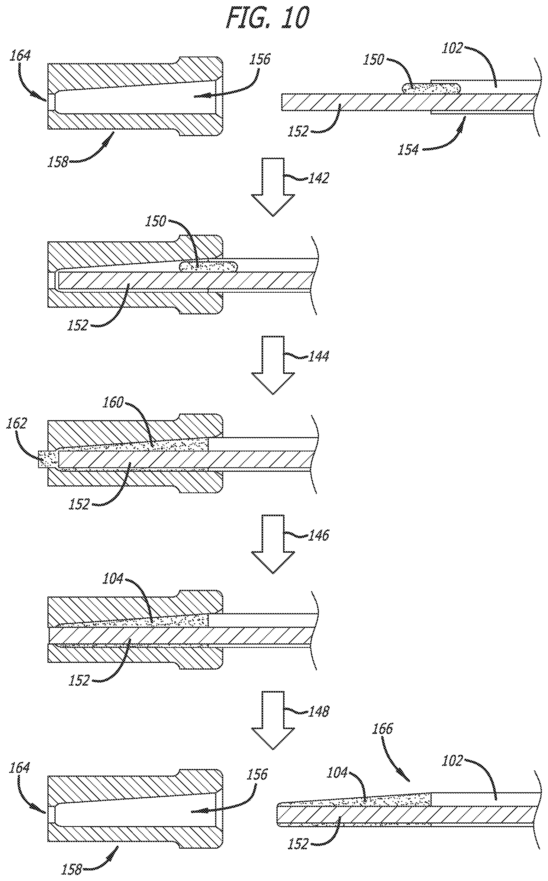 Patent US12599748 Figure 6 – Catheter tips for rapidly insertable central catheters and methods thereof