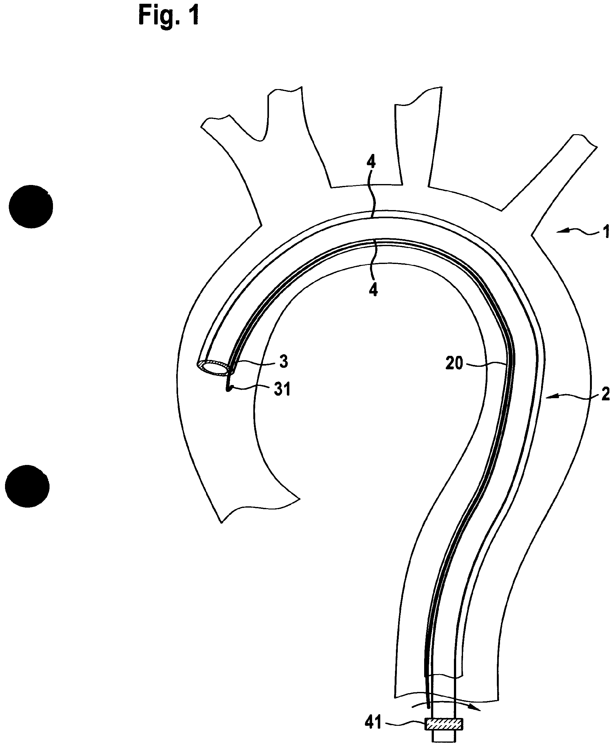 Patent US12599749 Figure 1 – Controllable insertion sleeve
