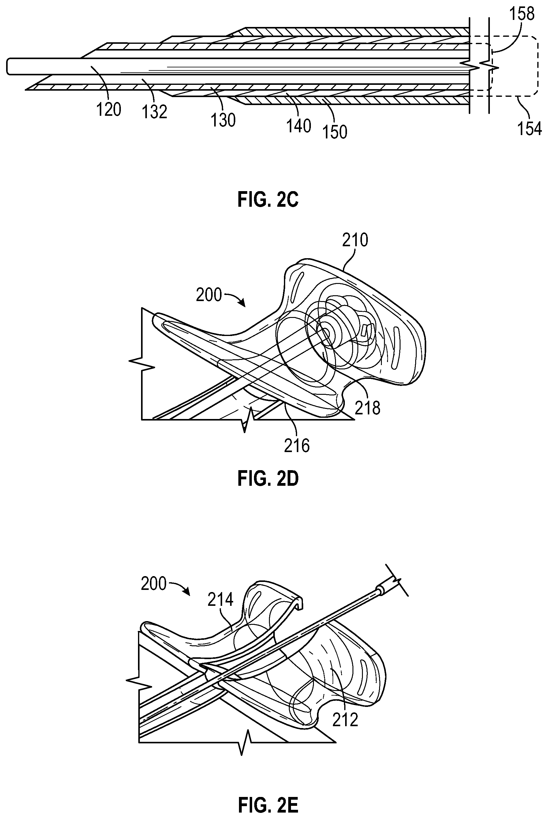 Patent US12599752 Figure 3 – Splitable catheter docking station system and method