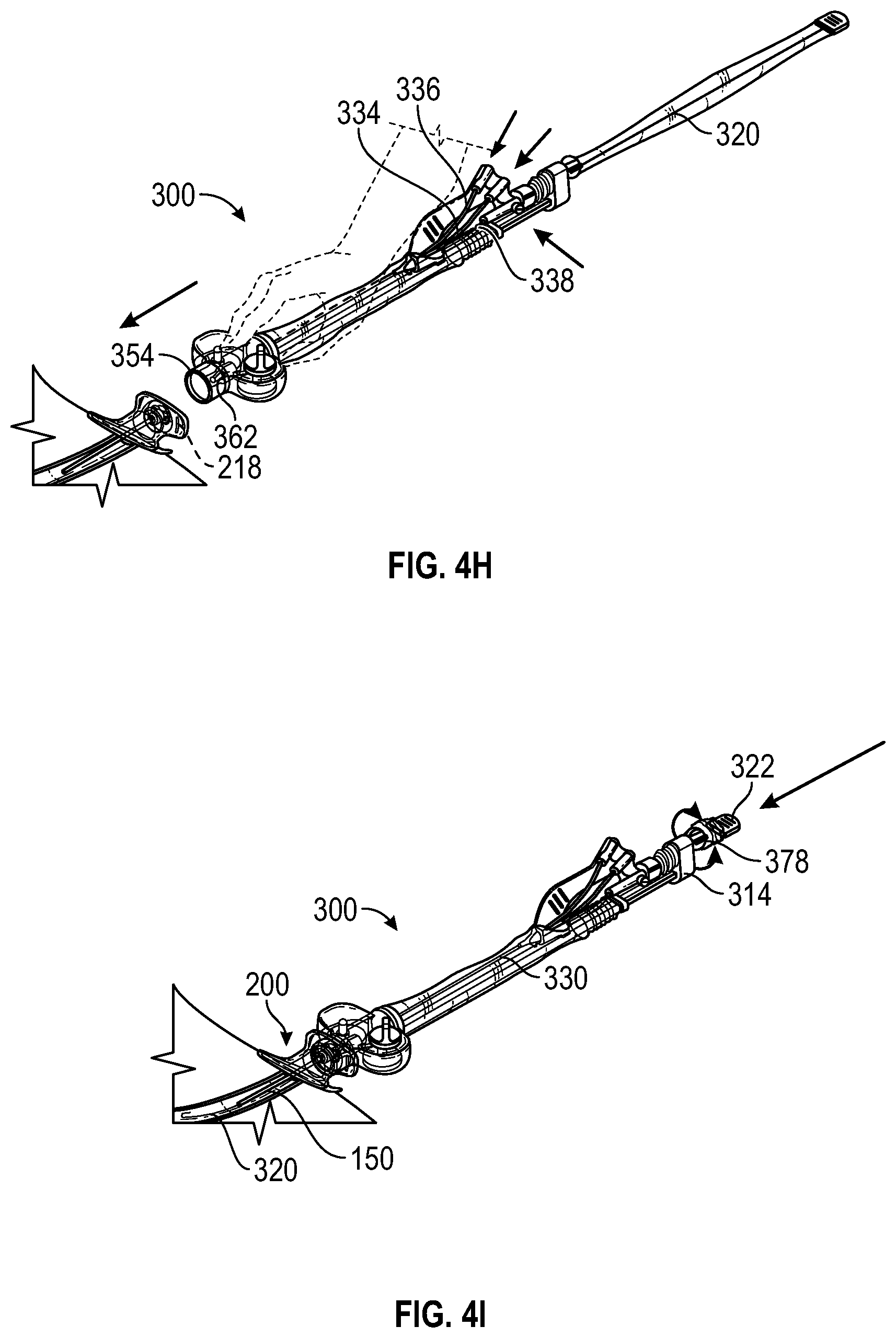 Patent US12599752 Figure 9 – Splitable catheter docking station system and method