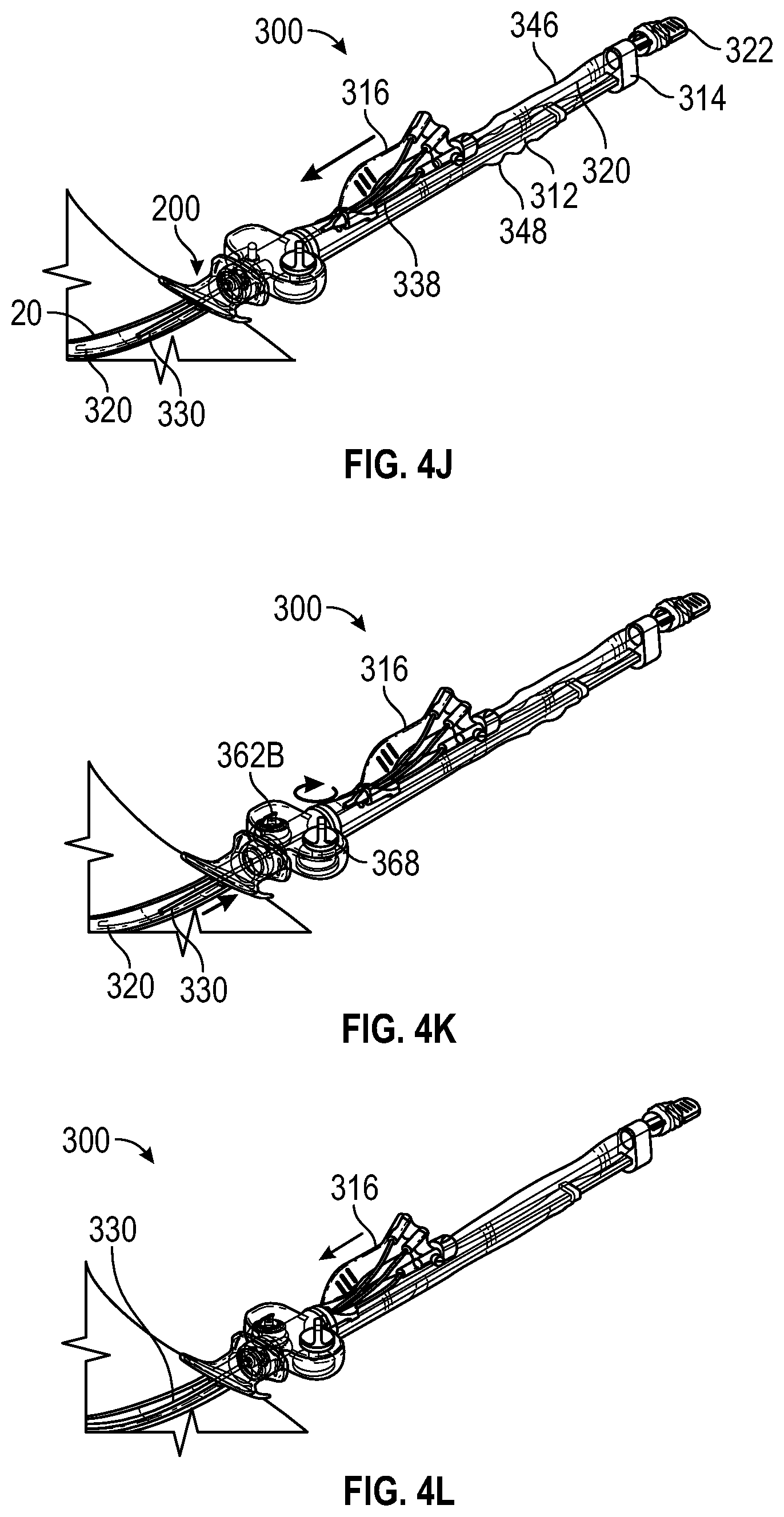 Patent US12599752 Figure 10 – Splitable catheter docking station system and method