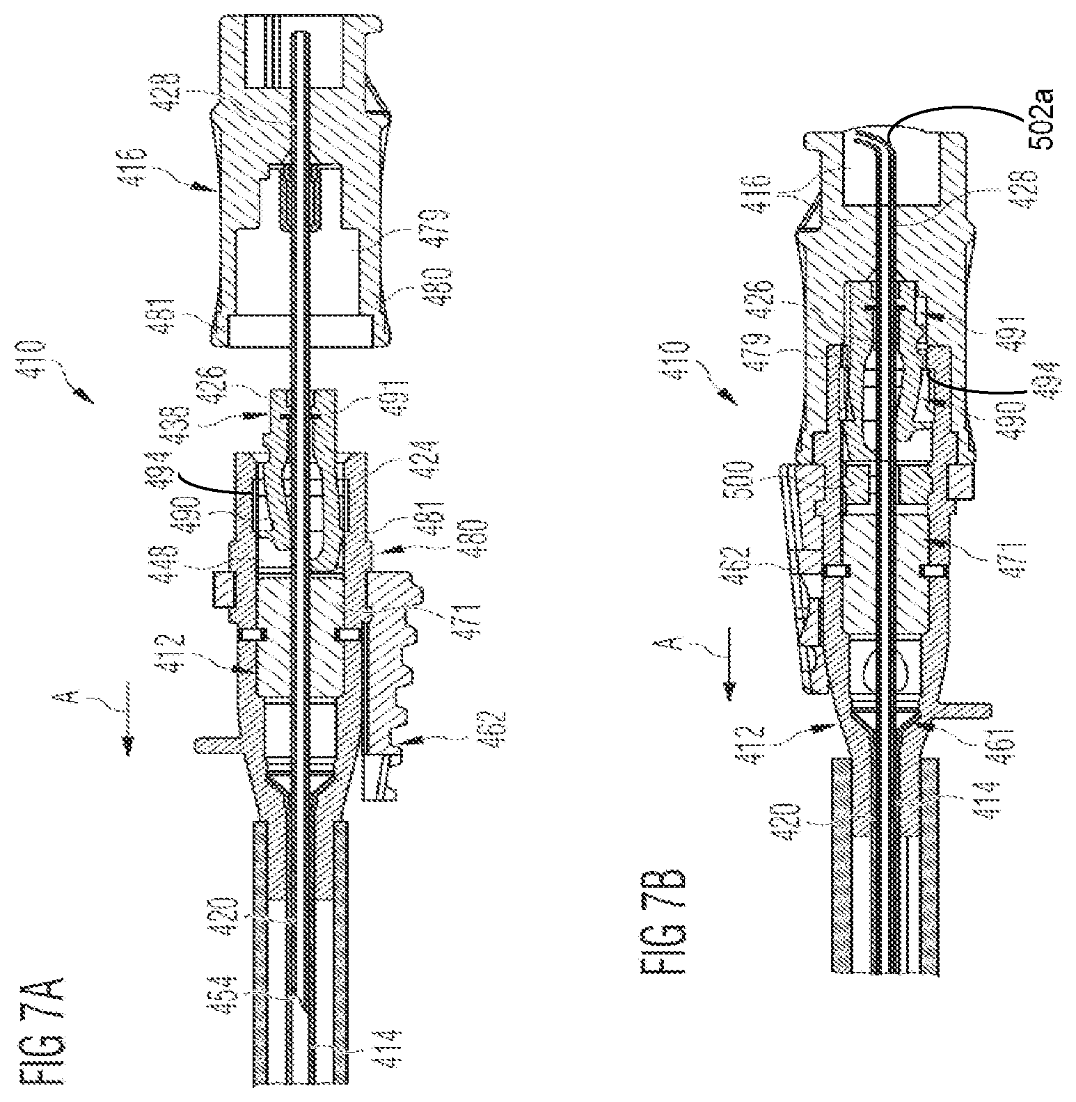 Patent US12599753 Figure 6 – Intravenous catheter assembly