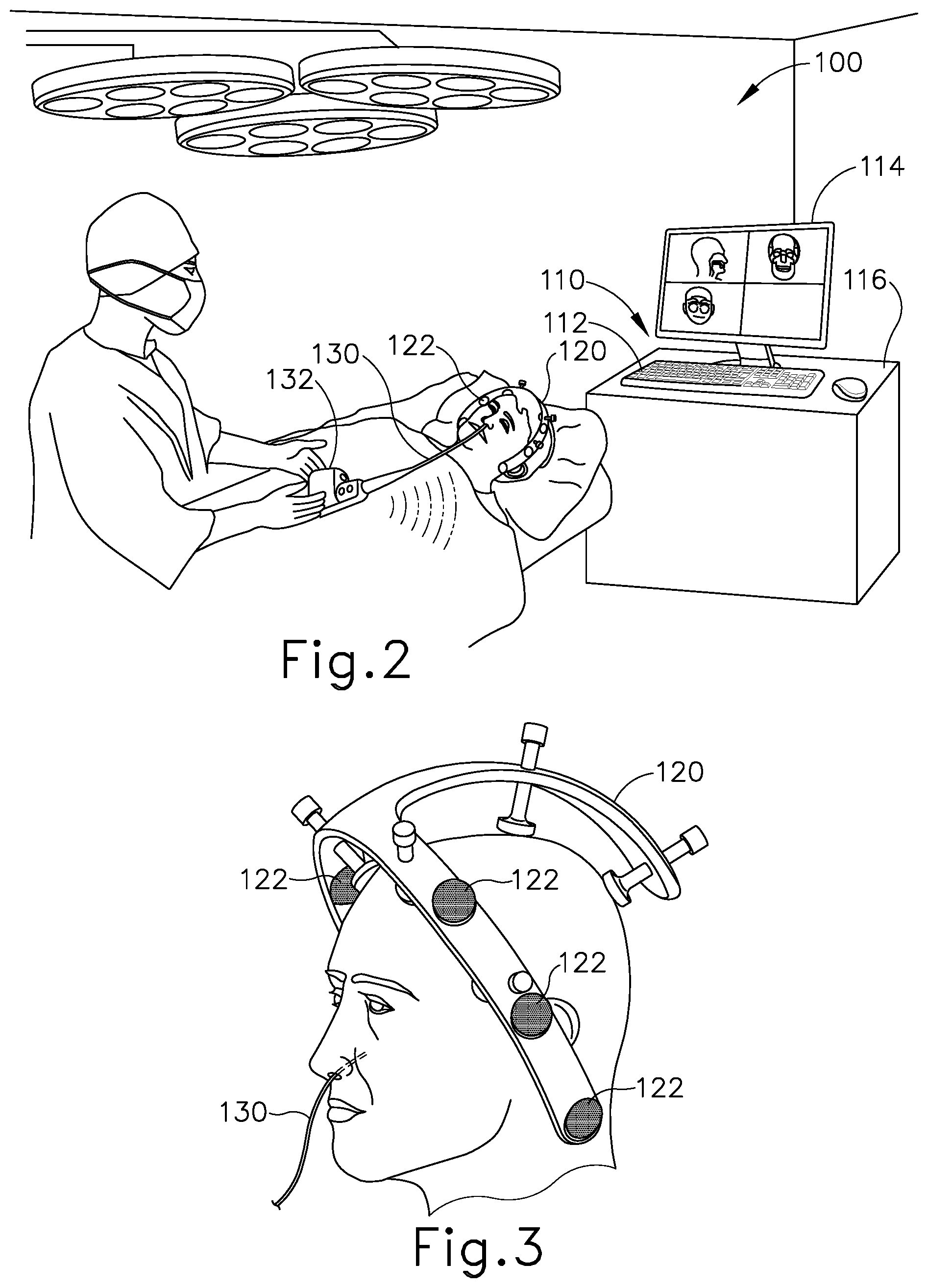 Patent US12599754 Figure 3 – Guidewire assembly with intertwined core wire
