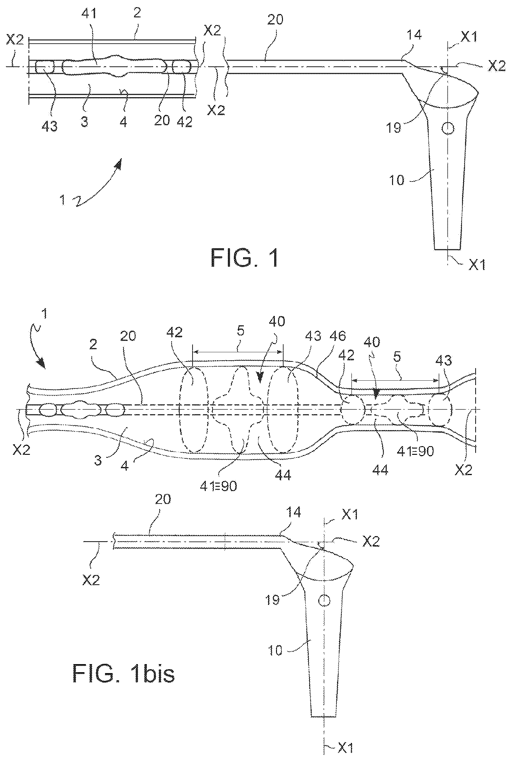 Patent US12599755 Figure 1 – Vascular catheter and method