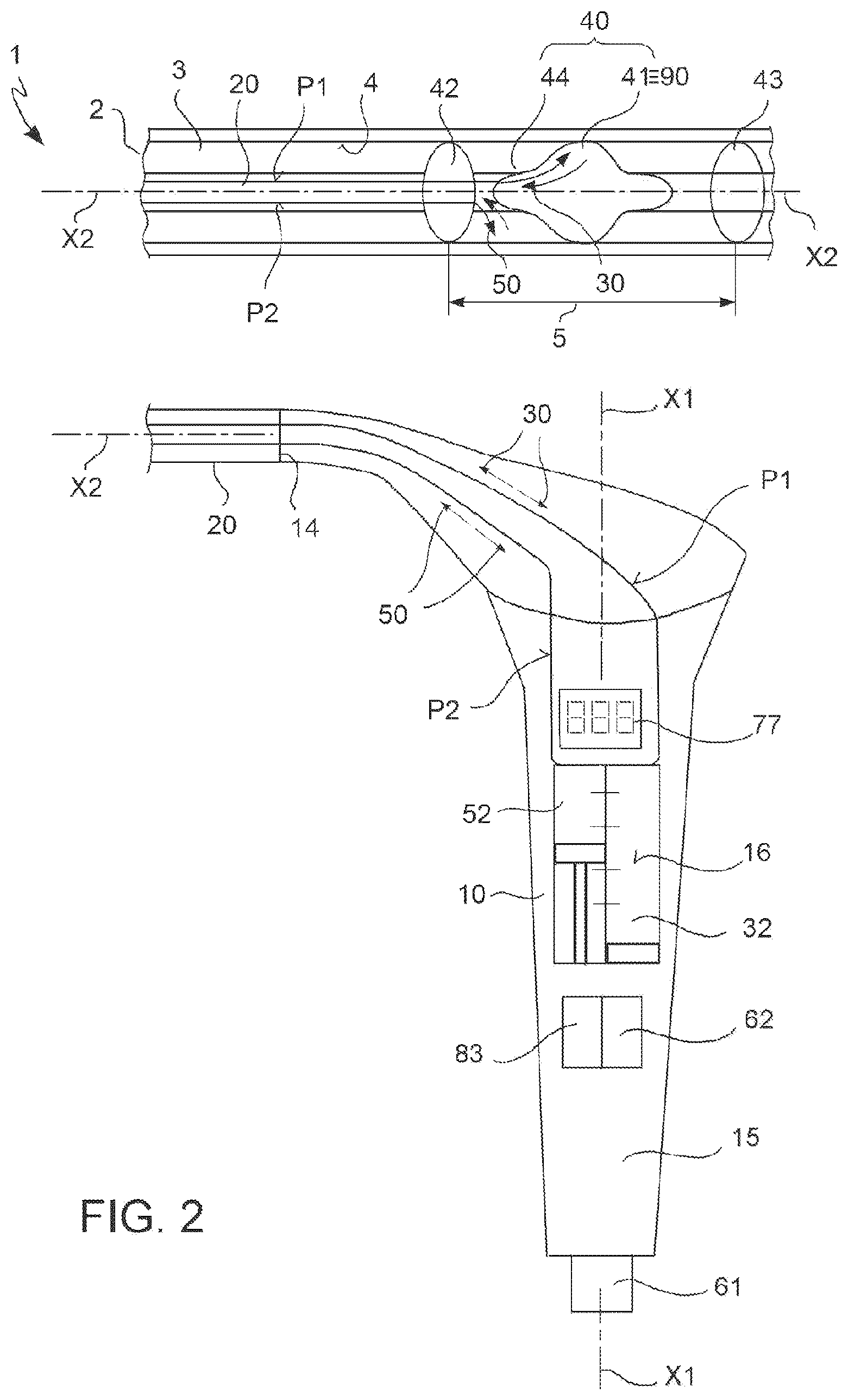 Patent US12599755 Figure 2 – Vascular catheter and method