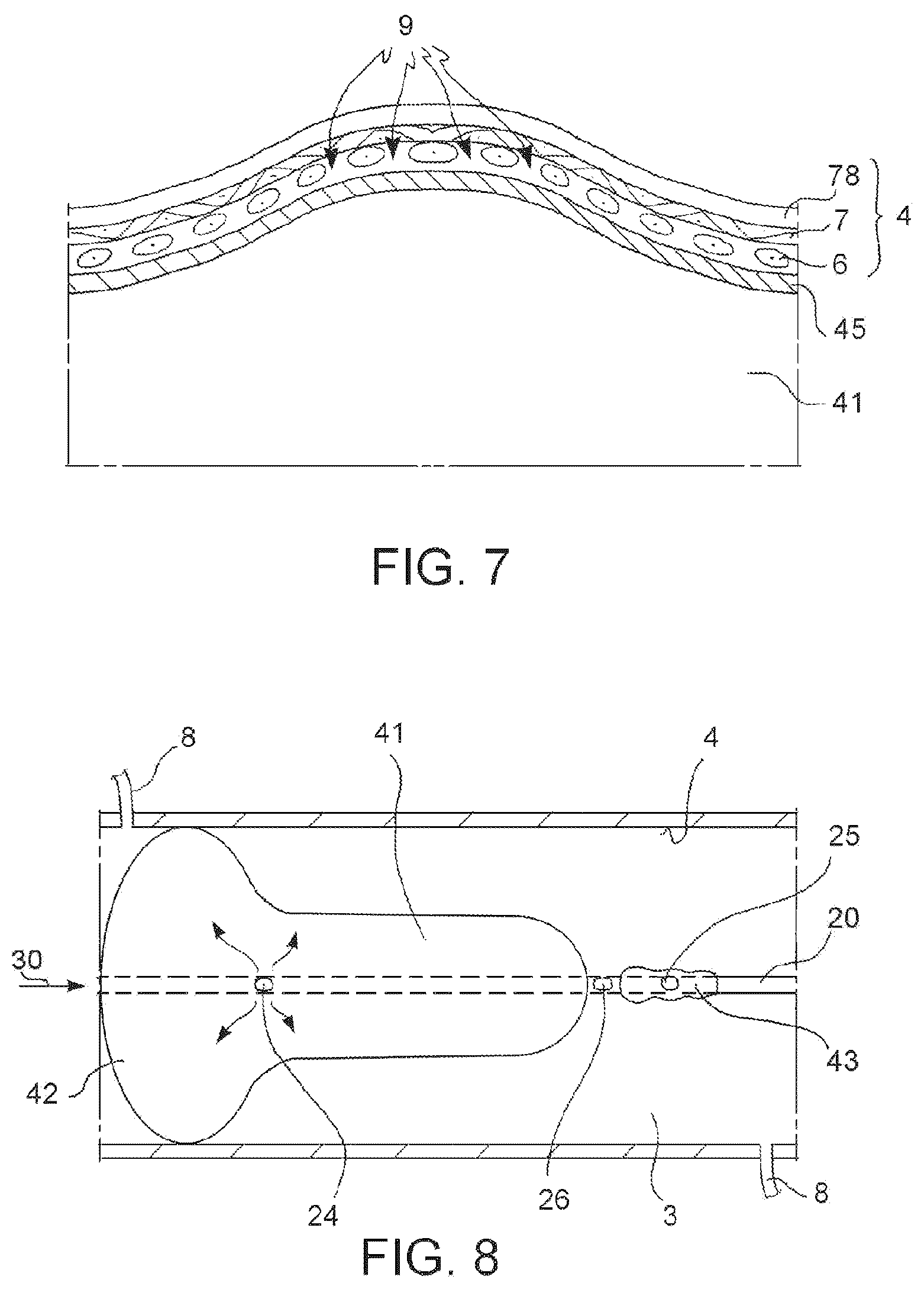 Patent US12599755 Figure 5 – Vascular catheter and method