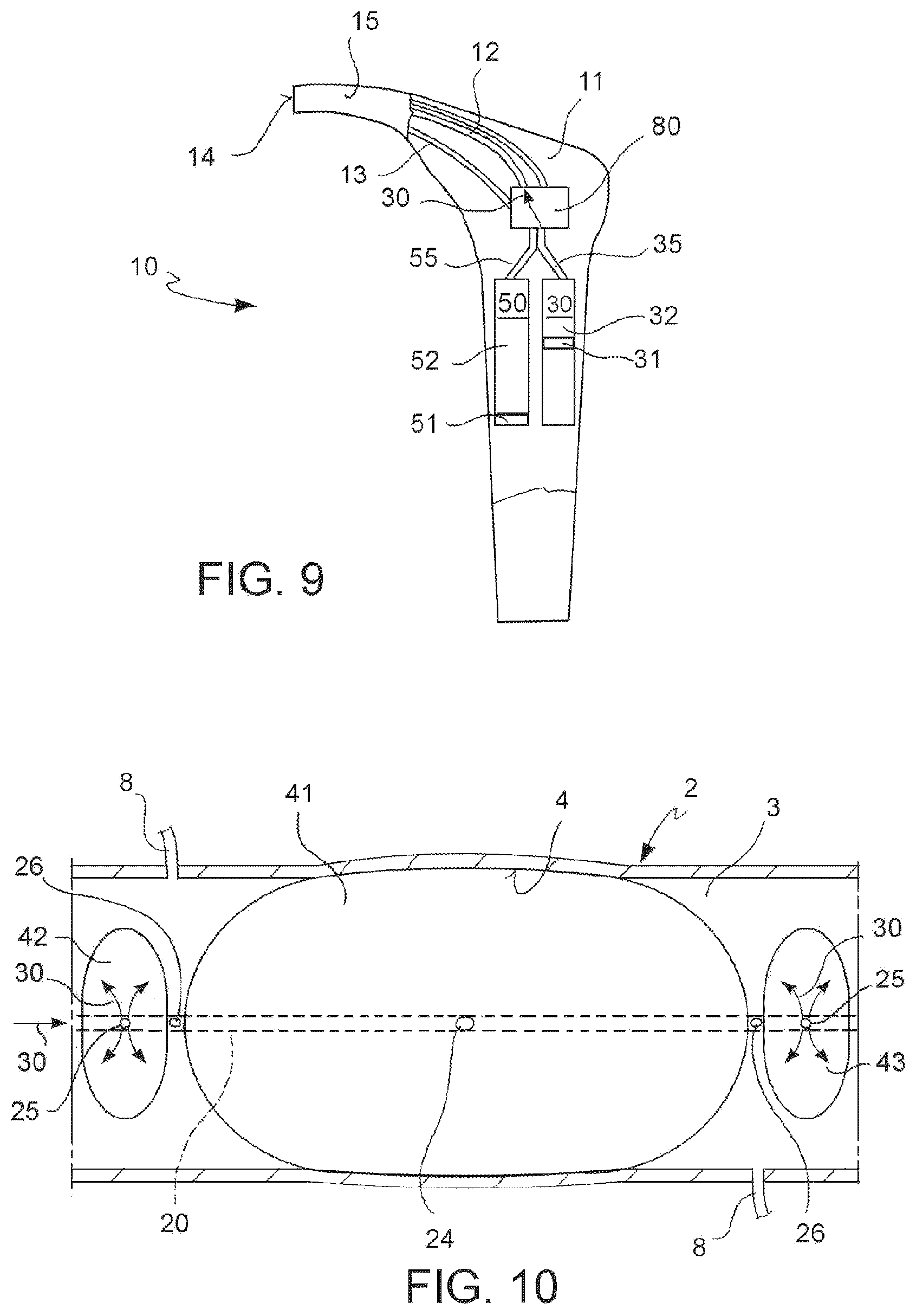 Patent US12599755 Figure 6 – Vascular catheter and method