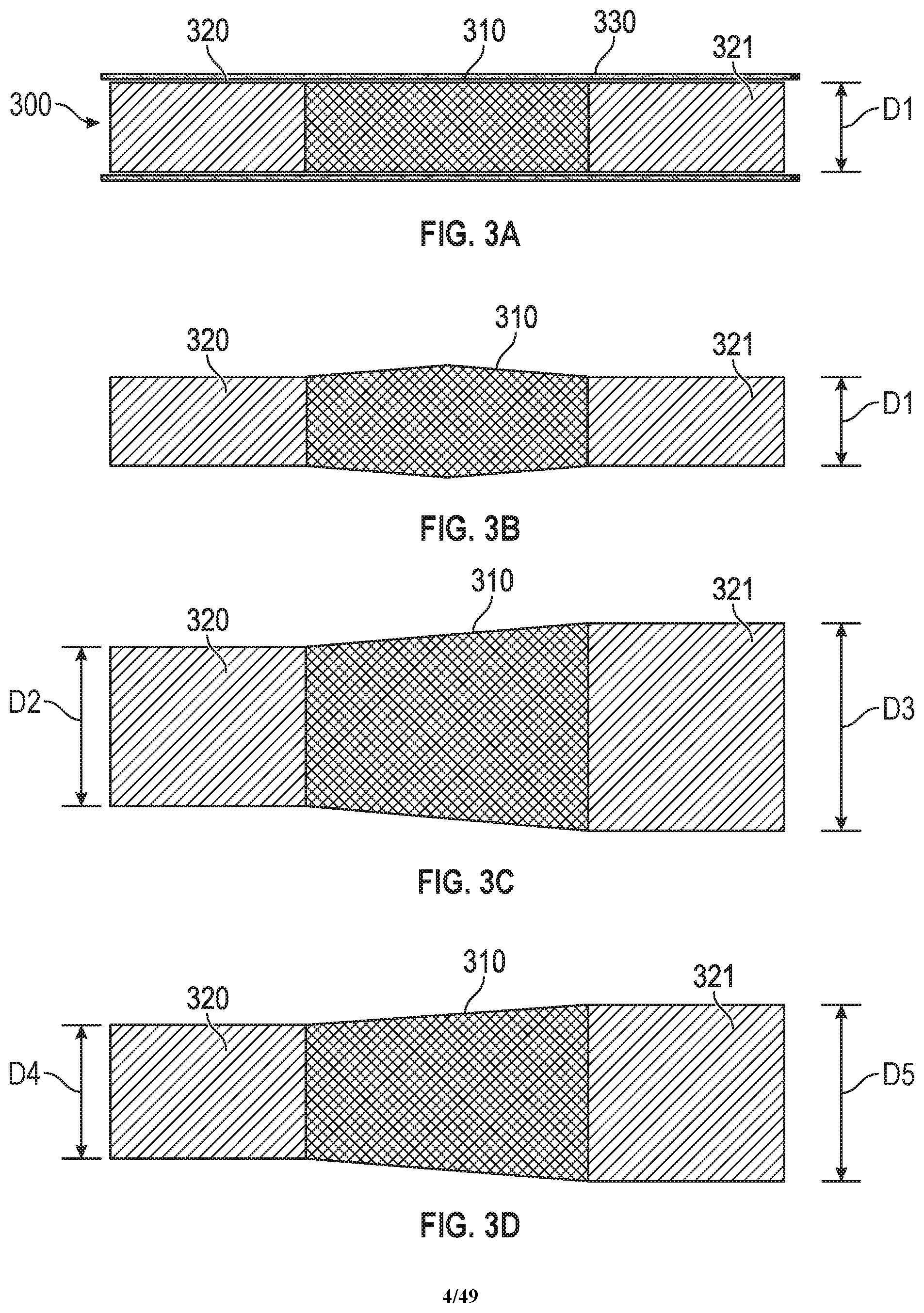 Patent US12599756 Figure 4 – Devices with dimensions that can be reduced and increased In Vivo