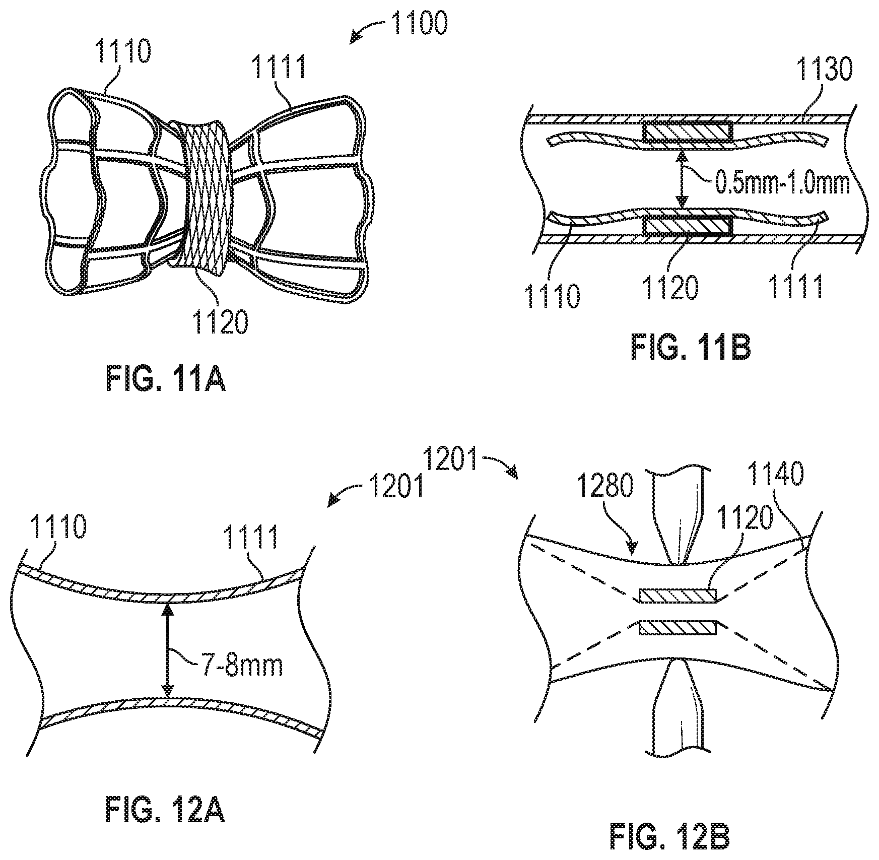 Patent US12599756 Figure 10 – Devices with dimensions that can be reduced and increased In Vivo