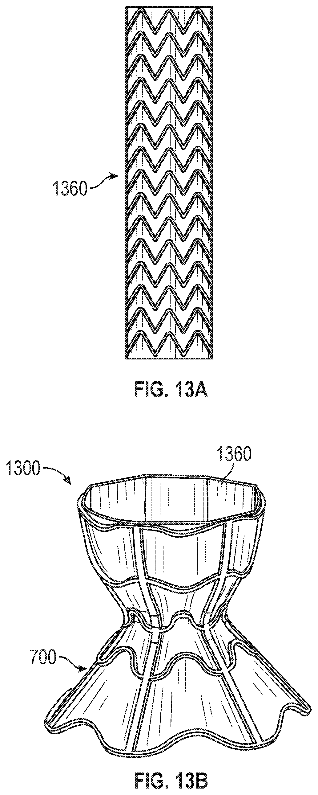 Patent US12599756 Figure 11 – Devices with dimensions that can be reduced and increased In Vivo