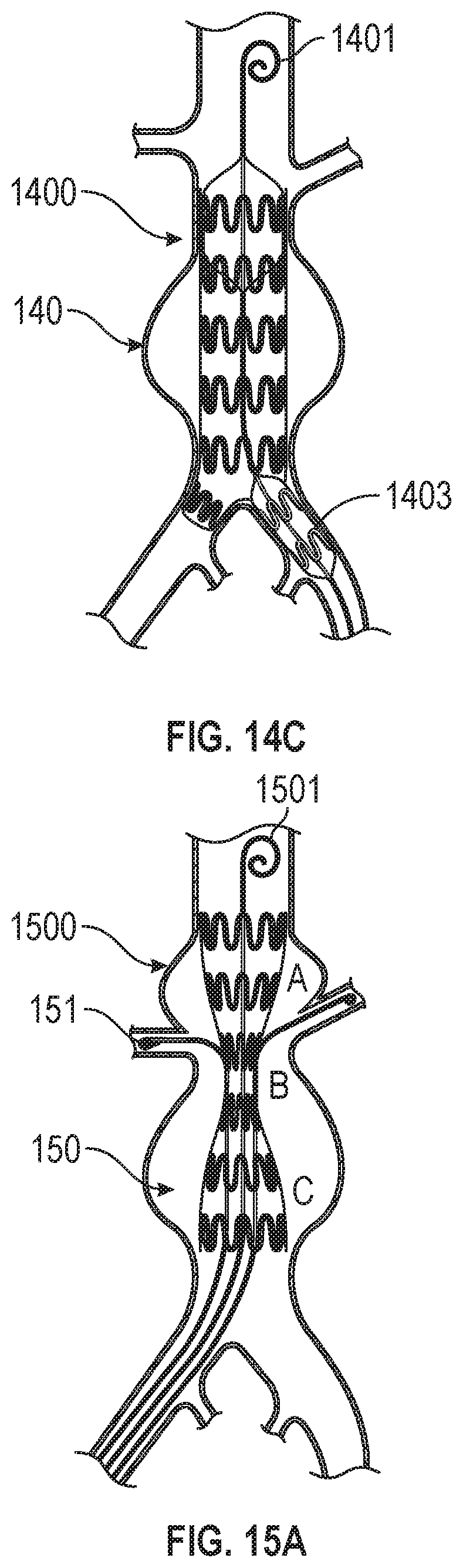 Patent US12599756 Figure 13 – Devices with dimensions that can be reduced and increased In Vivo