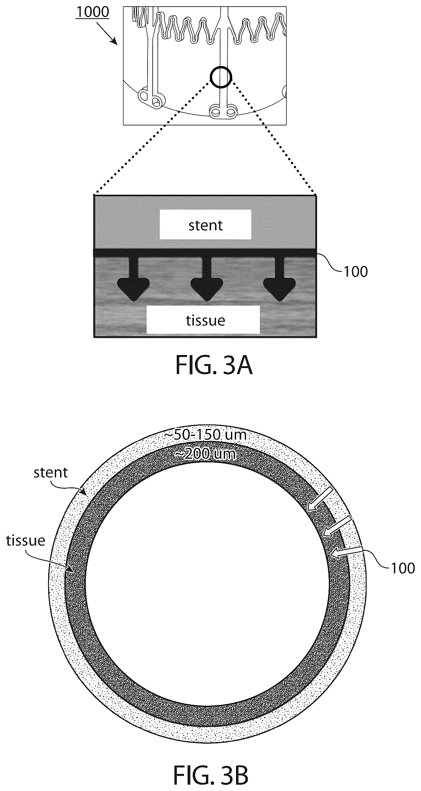 Patent US12599757 Figure 2 – Fabrication method for complex, re-entrant 3D microscale structures