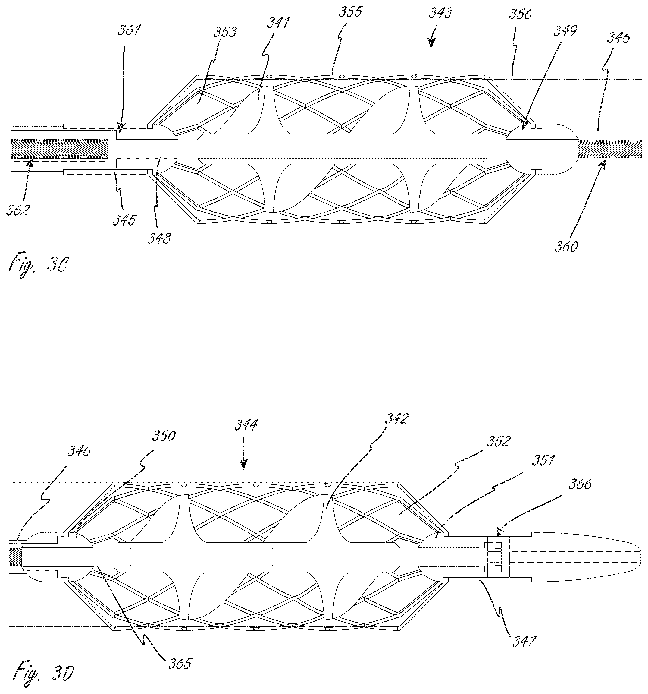 Patent US12599758 Figure 3 – Intravascular blood pumps, motors, and fluid control