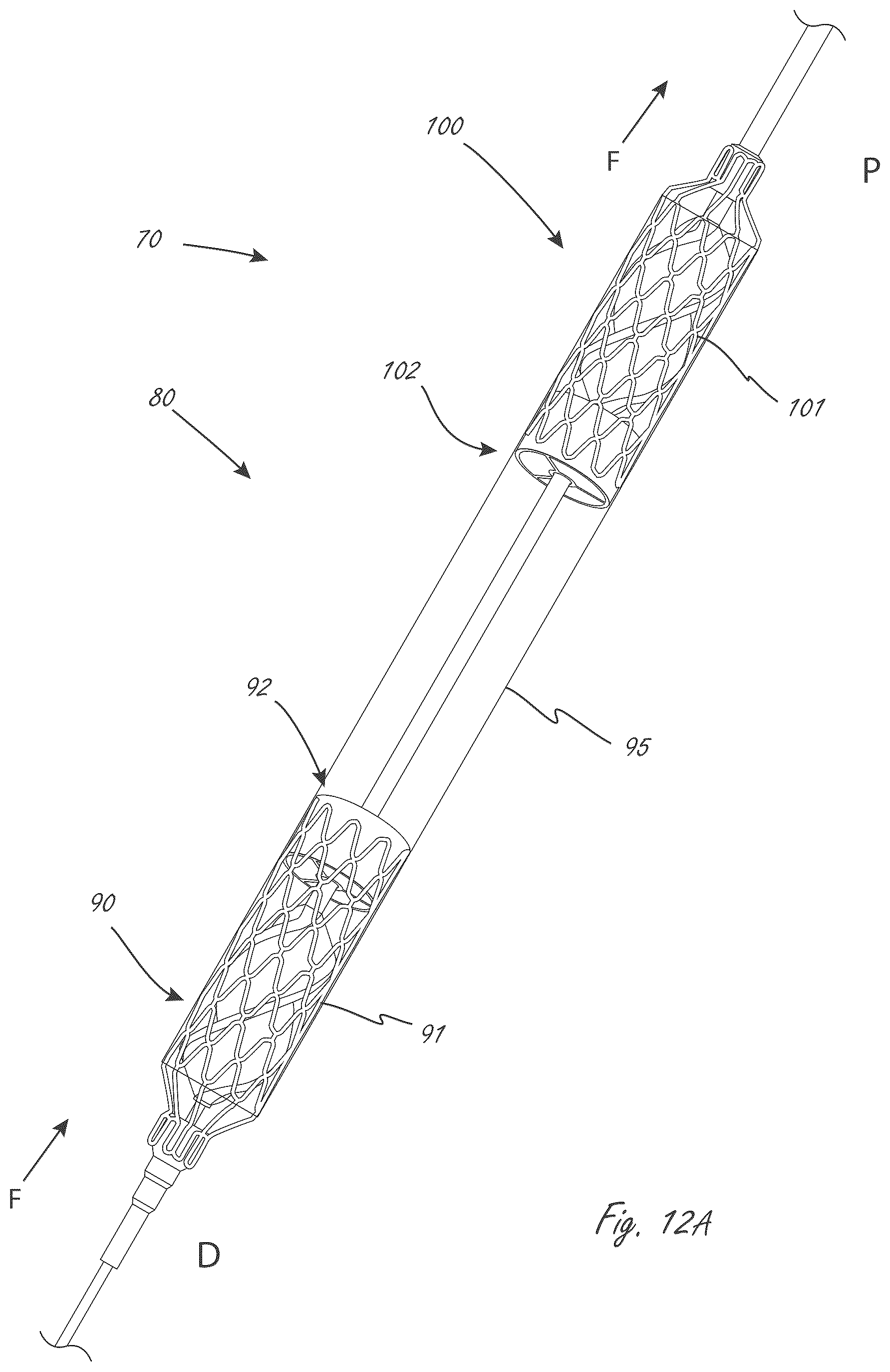 Patent US12599758 Figure 10 – Intravascular blood pumps, motors, and fluid control