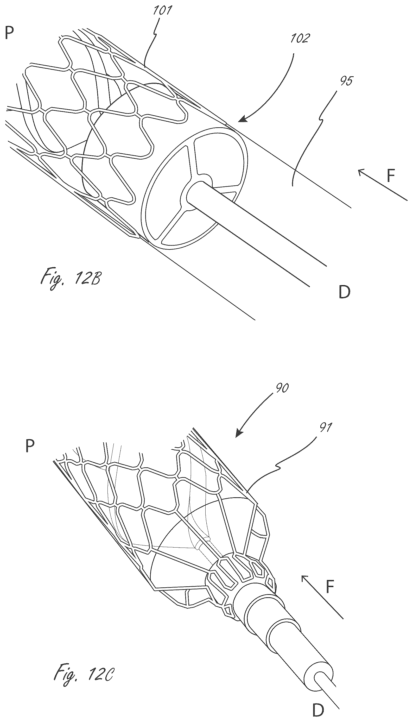 Patent US12599758 Figure 11 – Intravascular blood pumps, motors, and fluid control