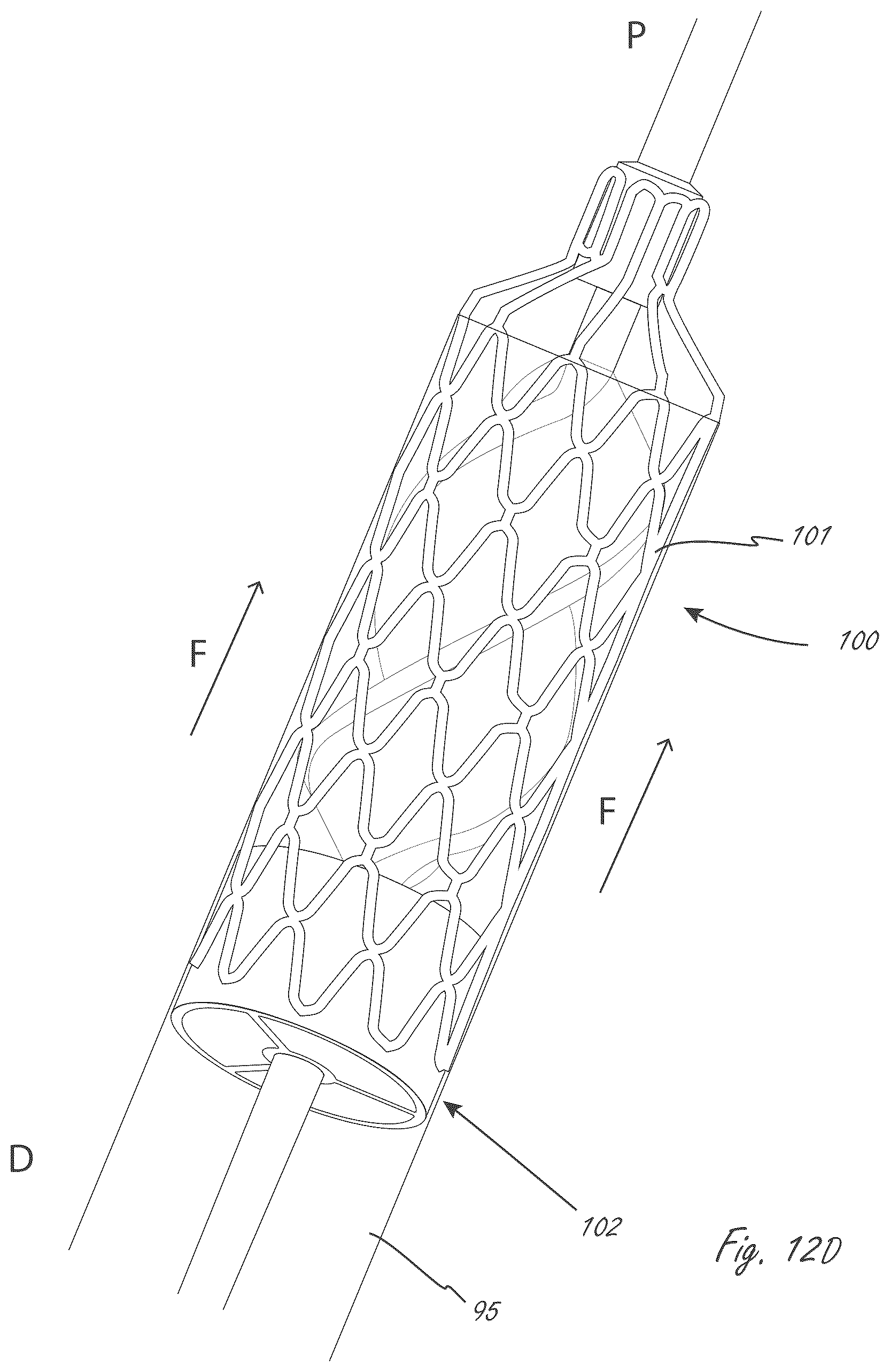 Patent US12599758 Figure 12 – Intravascular blood pumps, motors, and fluid control