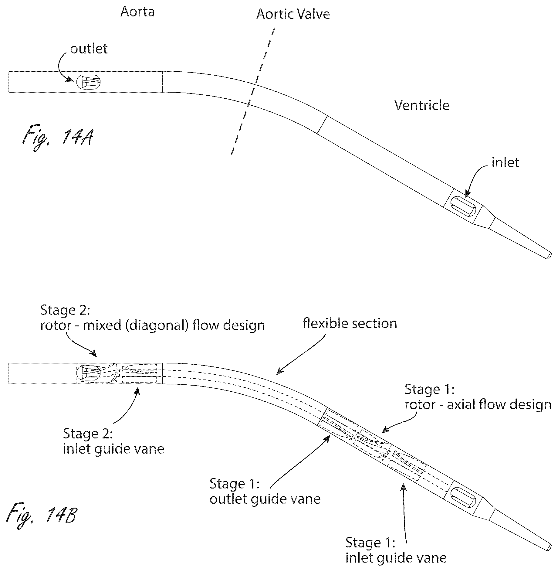Patent US12599758 Figure 14 – Intravascular blood pumps, motors, and fluid control