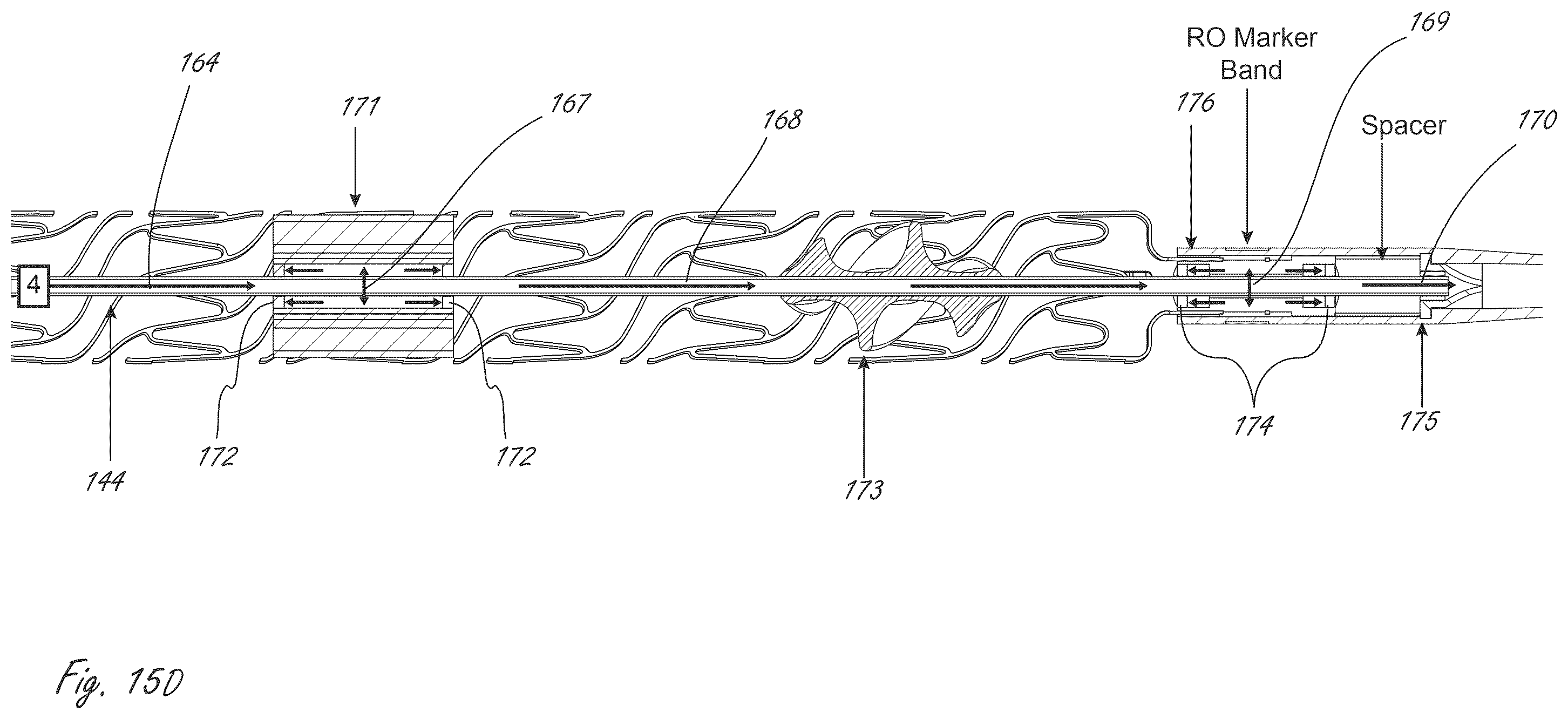 Patent US12599758 Figure 18 – Intravascular blood pumps, motors, and fluid control