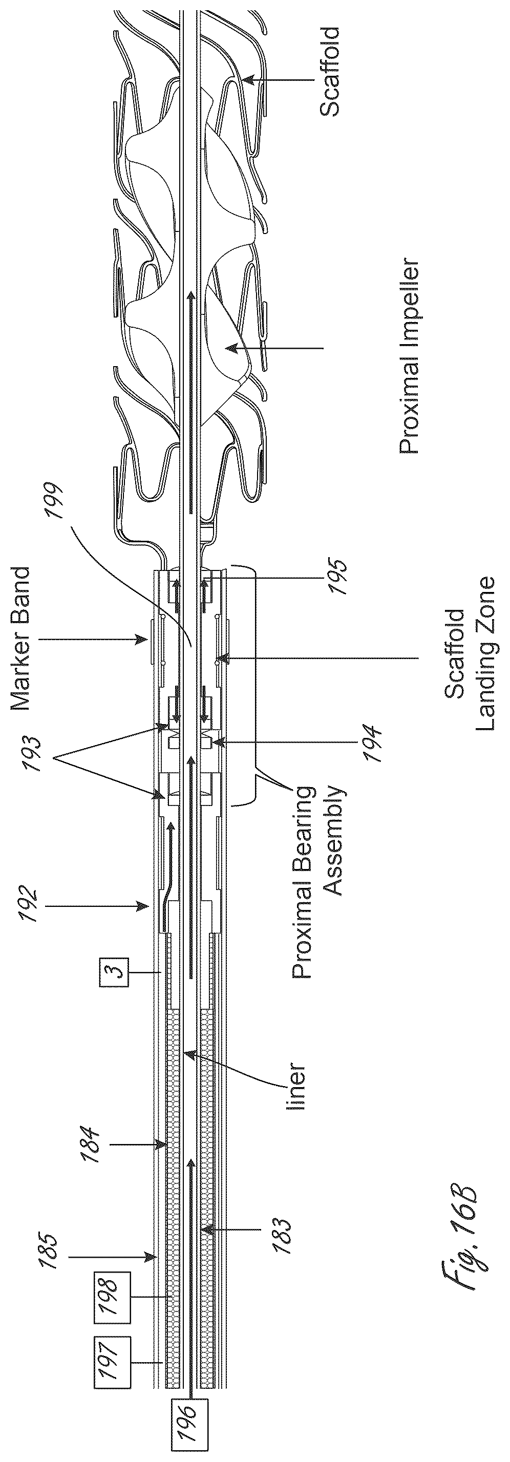 Patent US12599758 Figure 20 – Intravascular blood pumps, motors, and fluid control