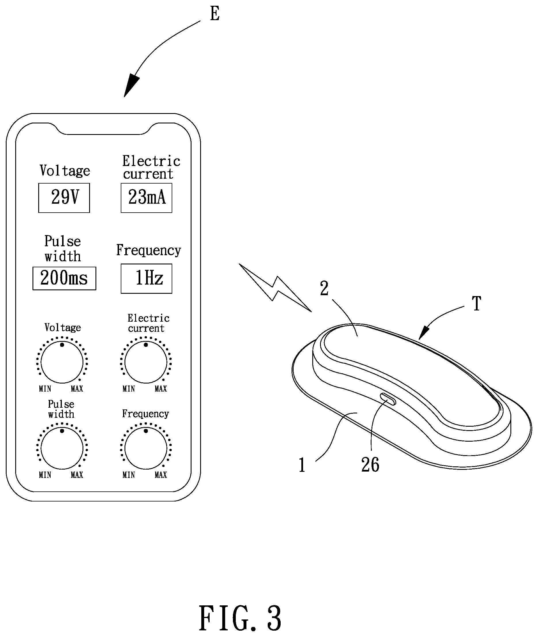 Patent US12599759 Figure 3 – Non-implantable training method for training genioglossus muscle strength