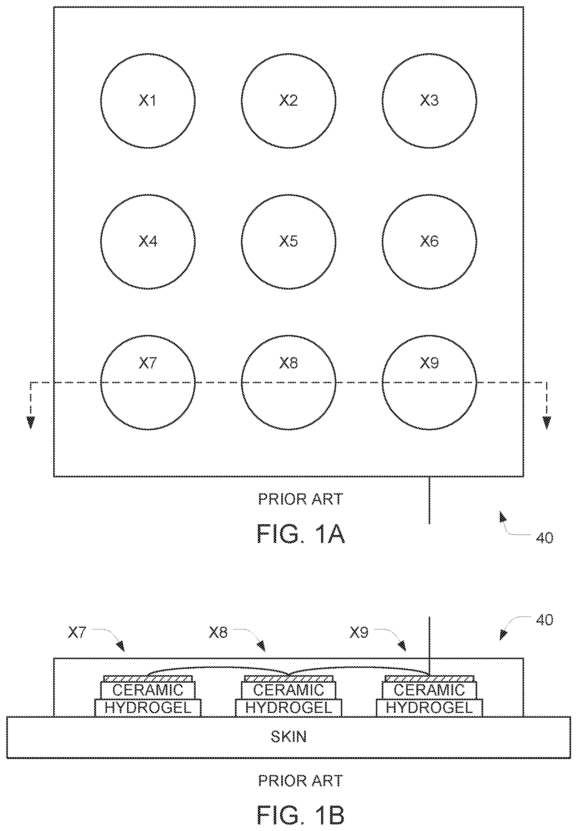 Patent US12599761 — Systems and methods for removing and replacing conductive adhesive layers of an electrode array — Figure 1