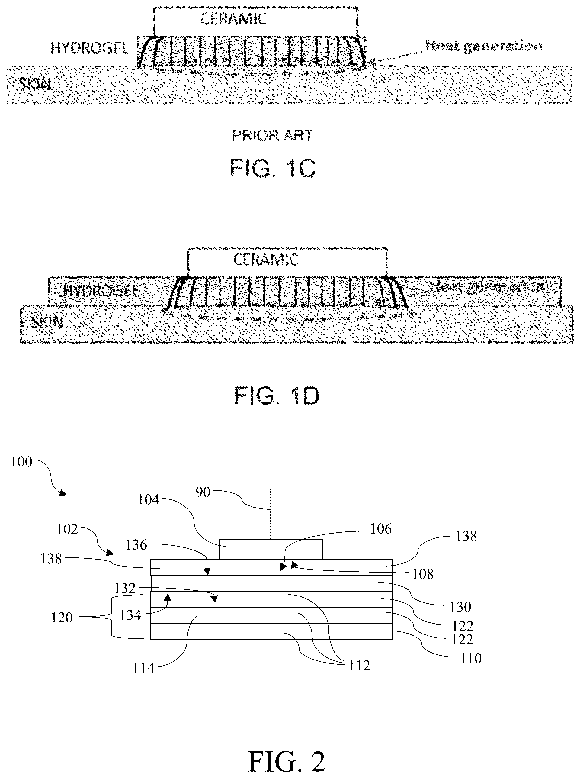 Patent US12599761 Figure 2 – Systems and methods for removing and replacing conductive adhesive layers of an electrode array