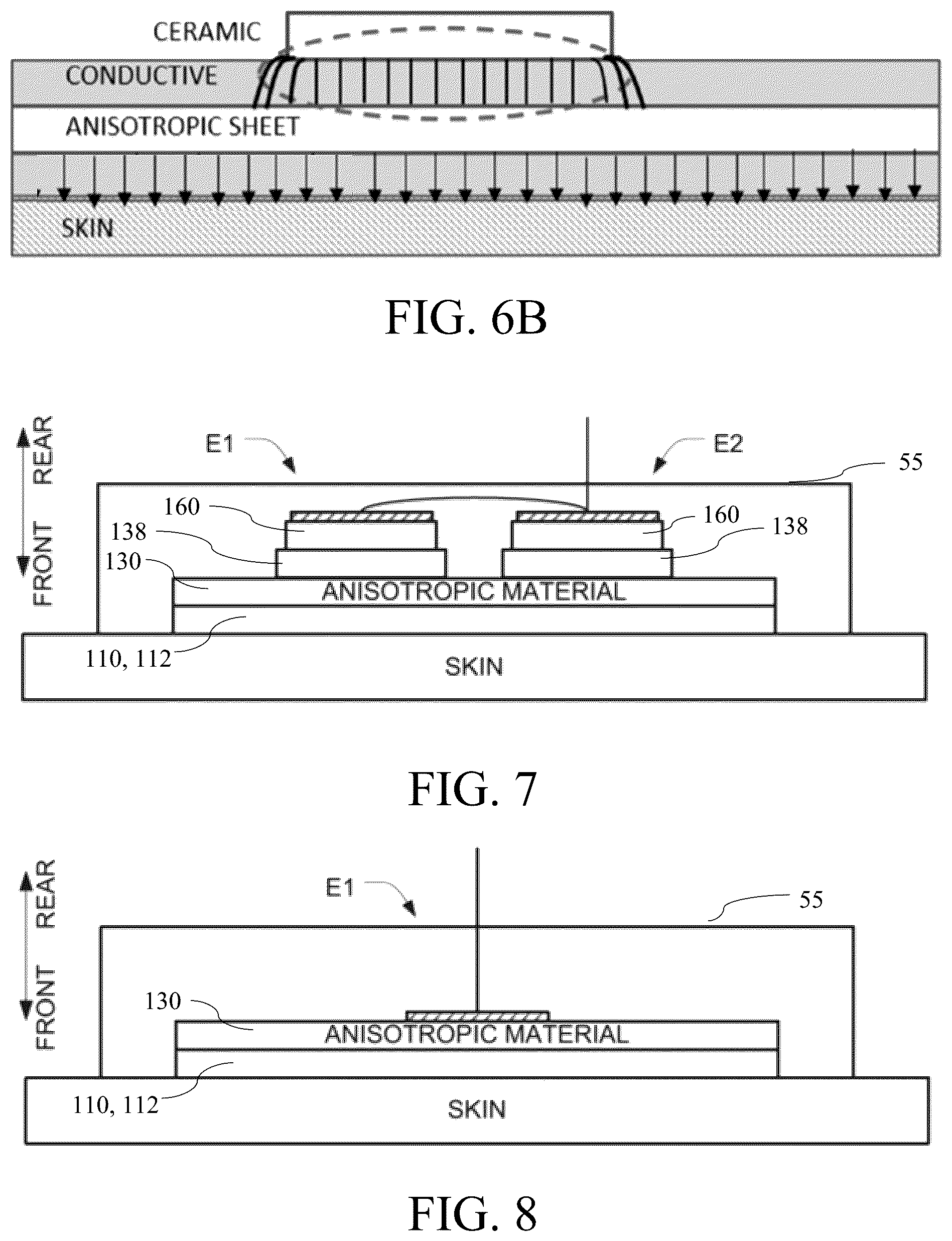 Patent US12599761 Figure 5 – Systems and methods for removing and replacing conductive adhesive layers of an electrode array