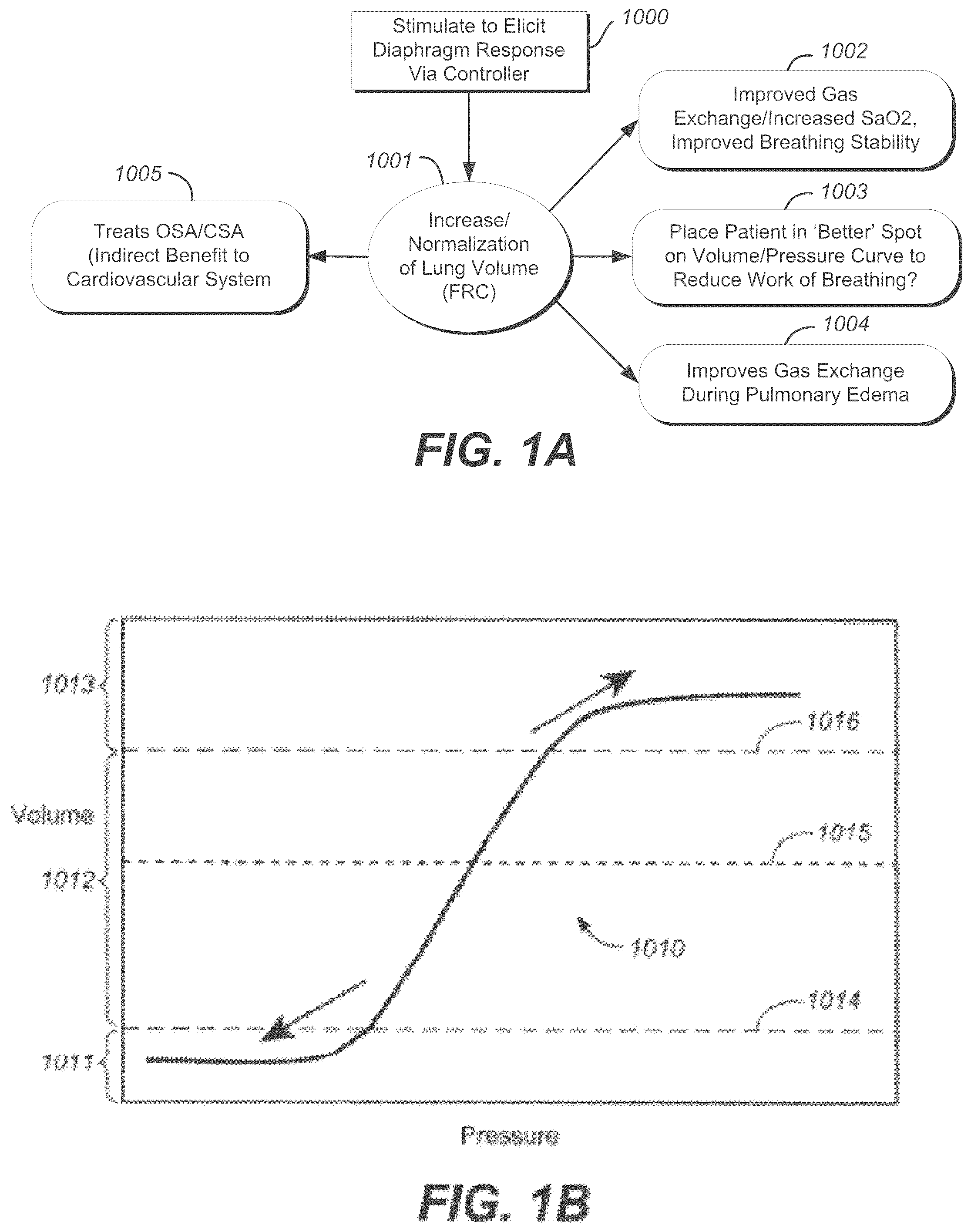 Patent US12599763 Figure 1 – Endovascular lead design and delivery systems