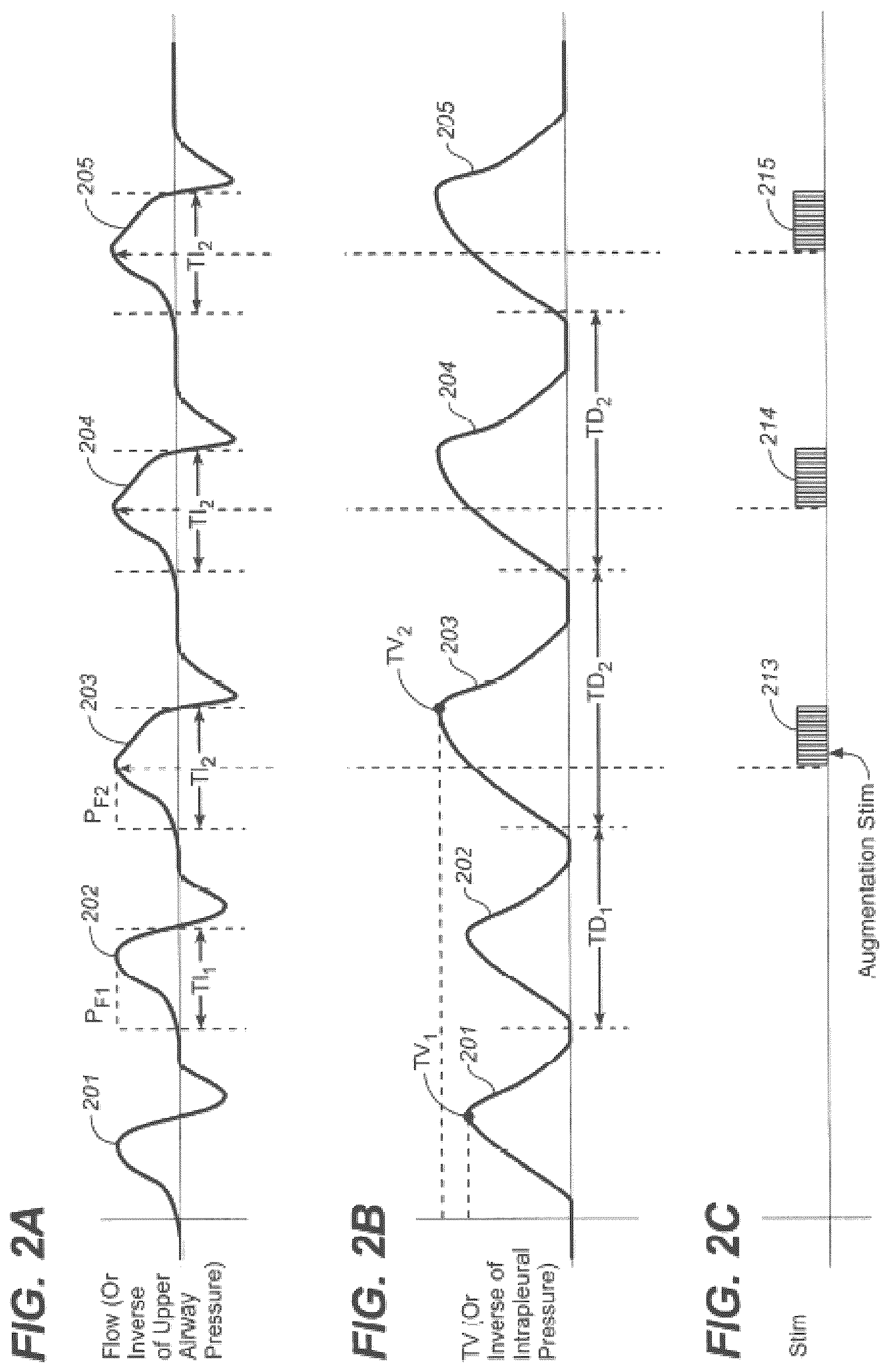 Patent US12599763 Figure 2 – Endovascular lead design and delivery systems