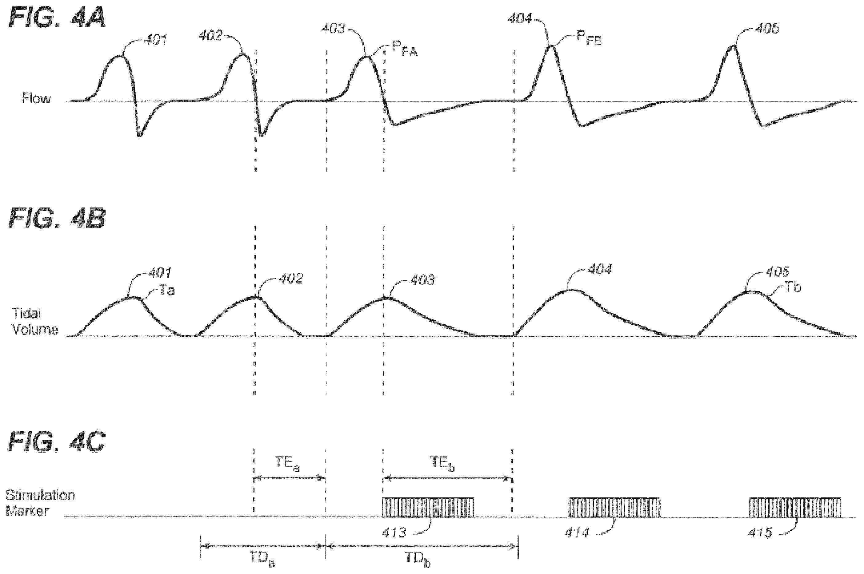 Patent US12599763 Figure 4 – Endovascular lead design and delivery systems
