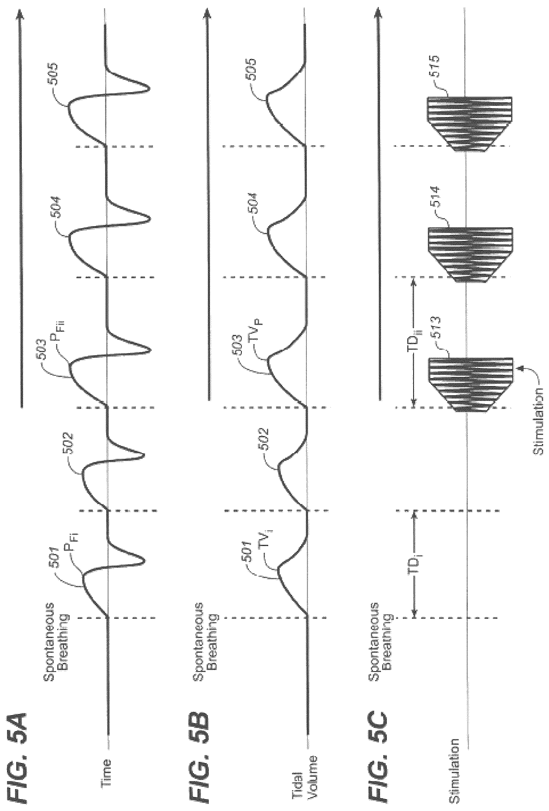 Patent US12599763 Figure 5 – Endovascular lead design and delivery systems