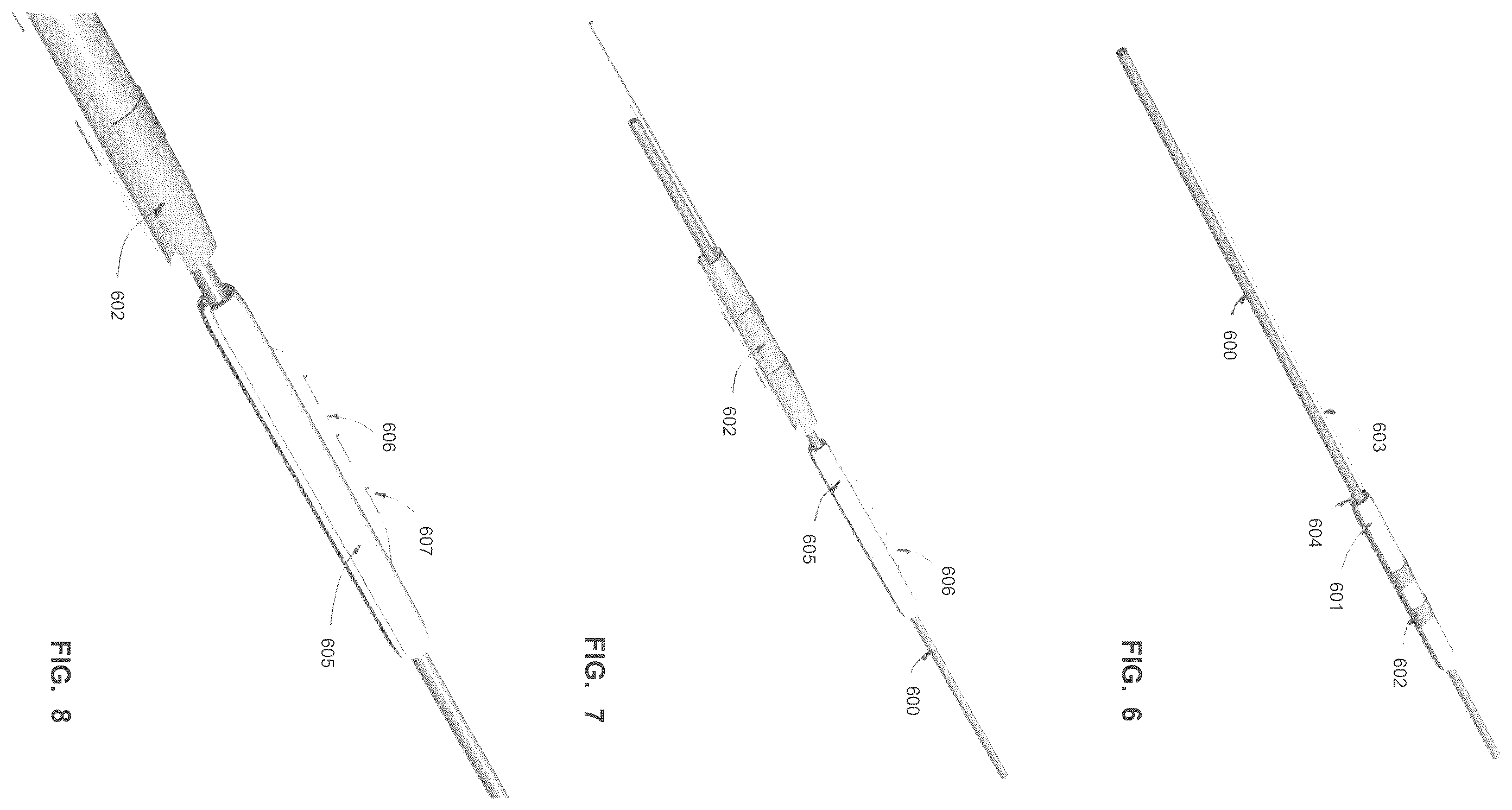Patent US12599763 Figure 6 – Endovascular lead design and delivery systems