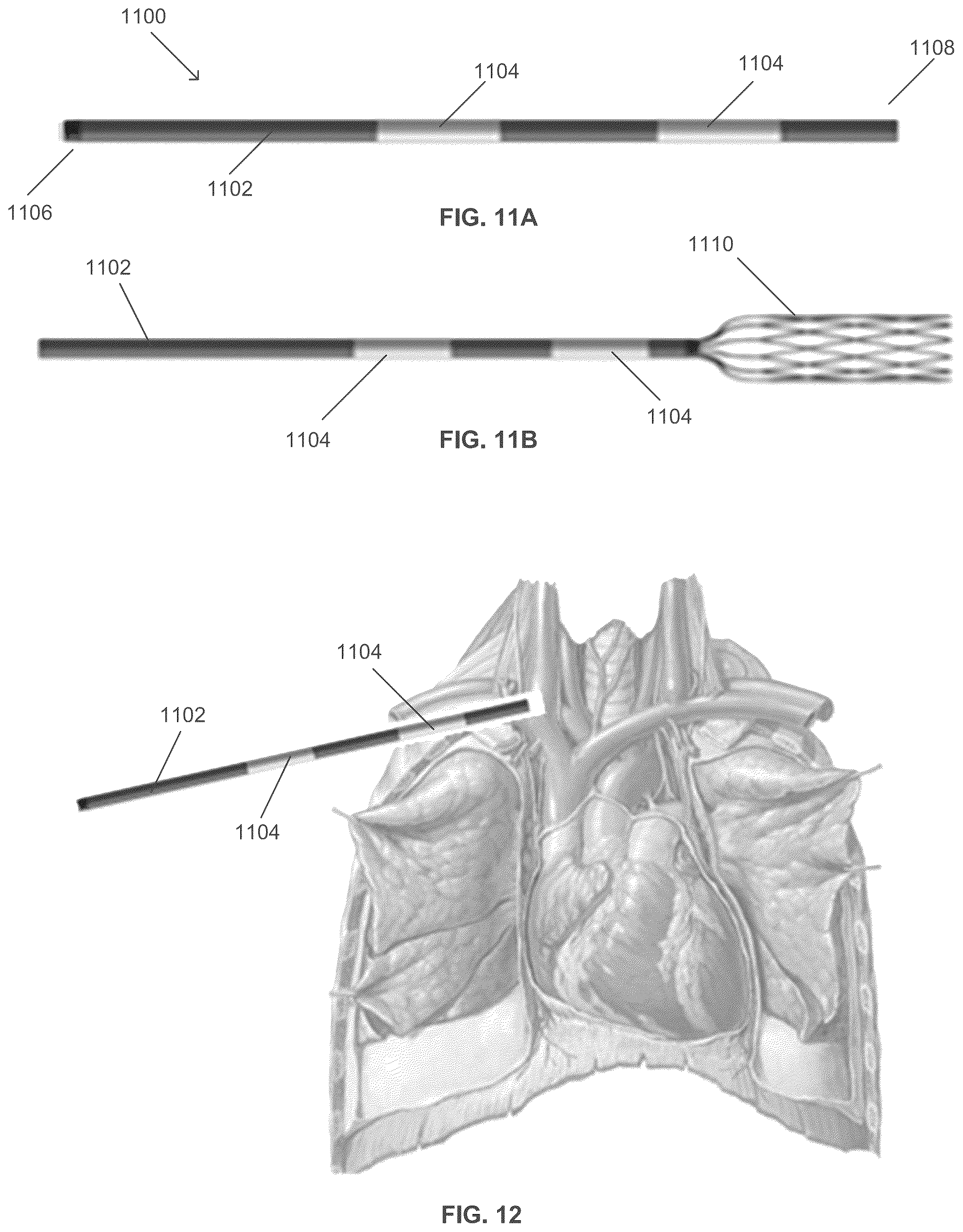 Patent US12599763 Figure 9 – Endovascular lead design and delivery systems