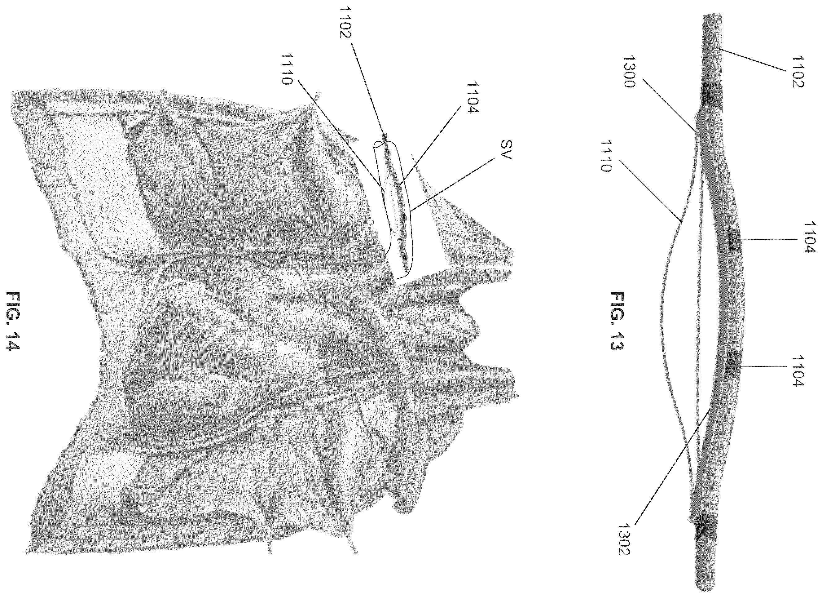 Patent US12599763 Figure 10 – Endovascular lead design and delivery systems