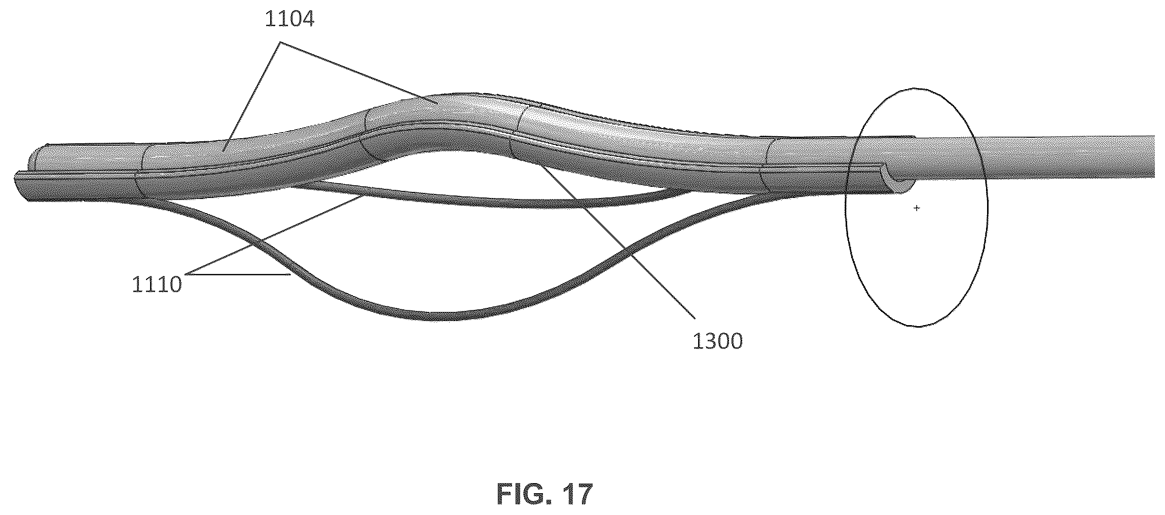 Patent US12599763 Figure 12 – Endovascular lead design and delivery systems