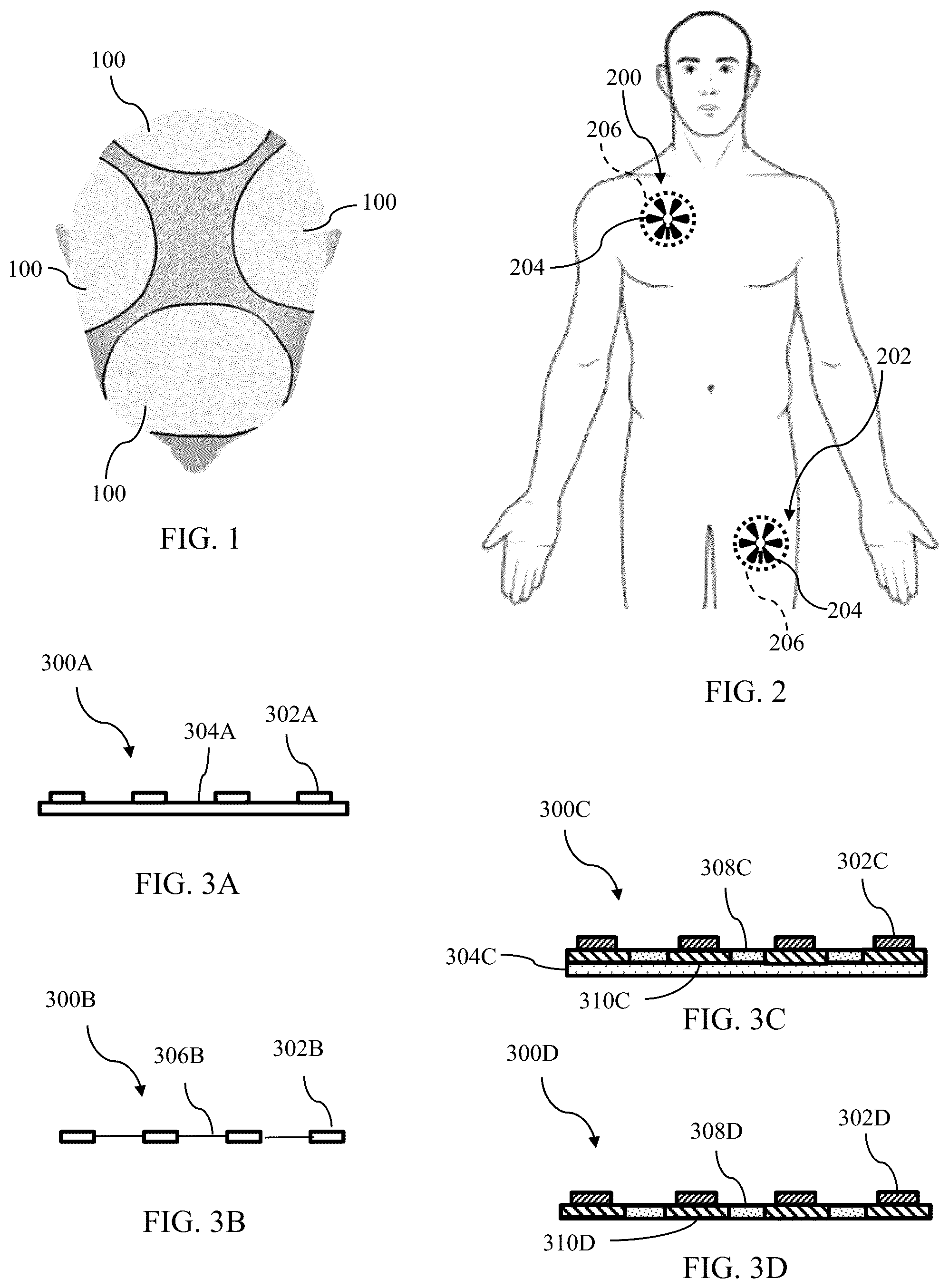 Patent US12599765 Figure 1 – Shifting of transducer array to reduce skin irritation