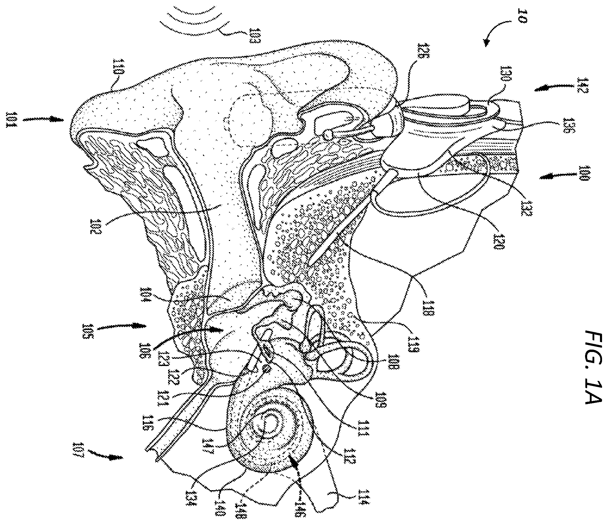 Patent US12599768 Figure 1 – Advanced electrode data analysis