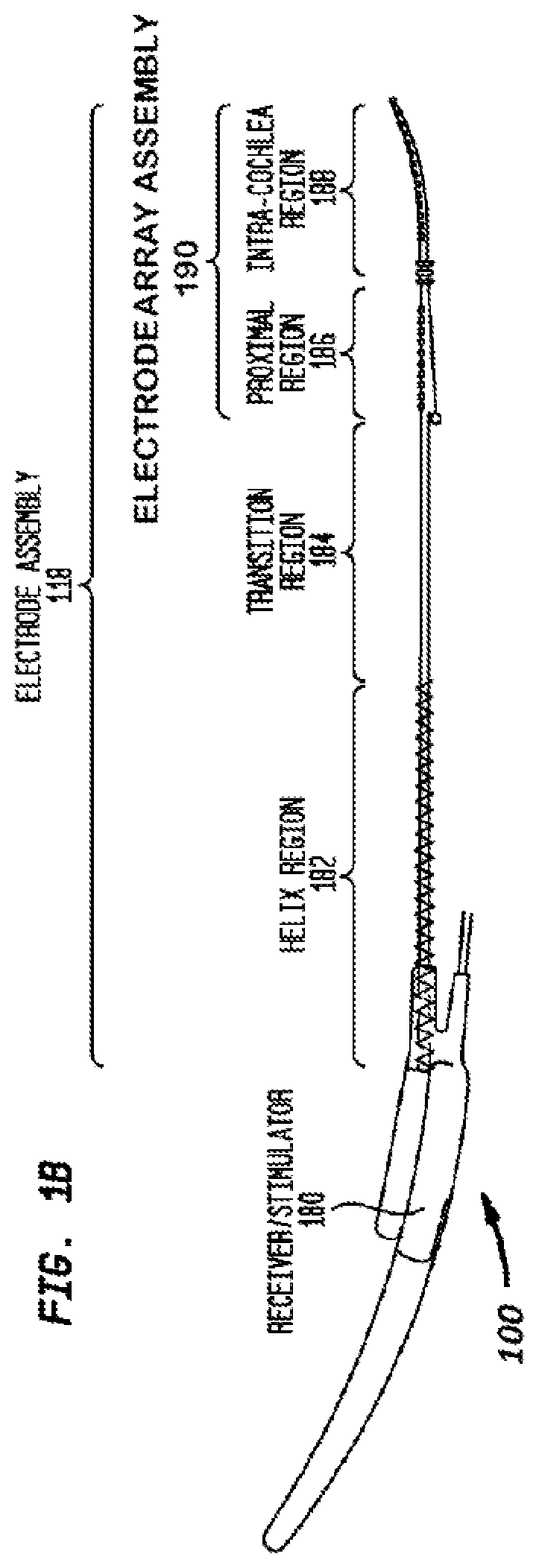 Patent US12599768 Figure 2 – Advanced electrode data analysis