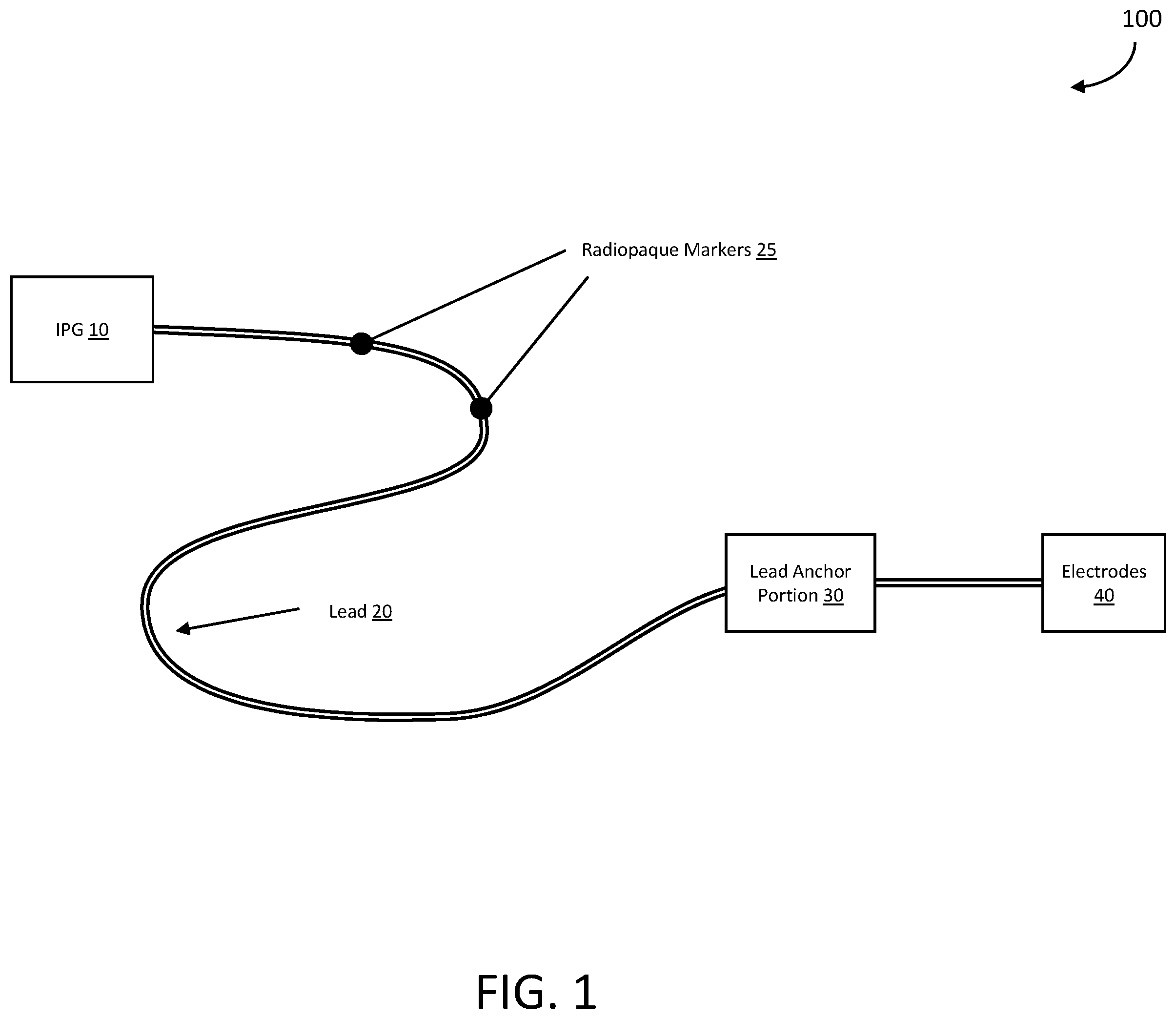 Patent US12599770 Figure 1 – Energy efficient electrical pulse generating device