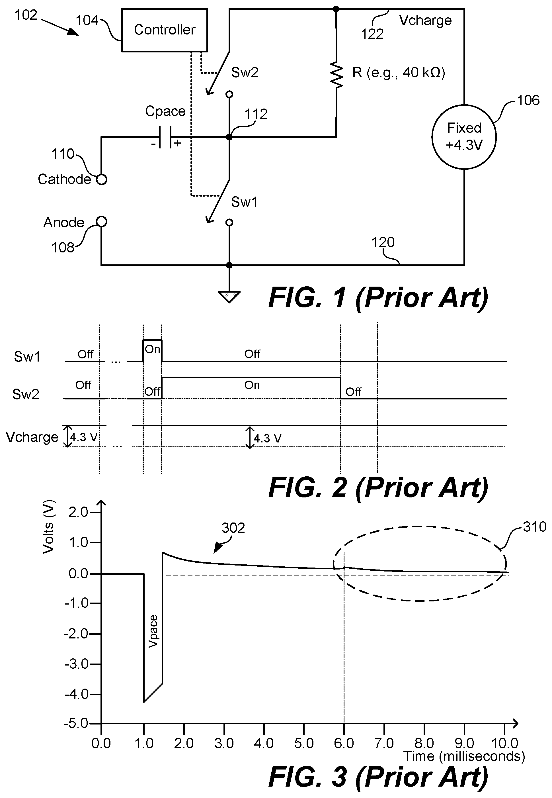 Patent US12599771 Figure 1 – Methods and devices for improved evoked response detection