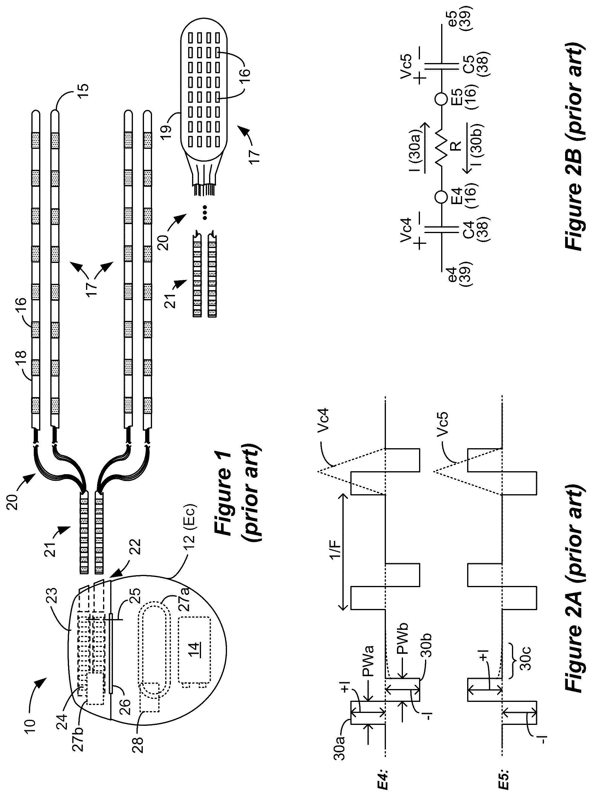 Patent US12599772 — Selection of sensing electrodes in a spinal cord stimulator system using sensed stimulation artifacts — Figure 1