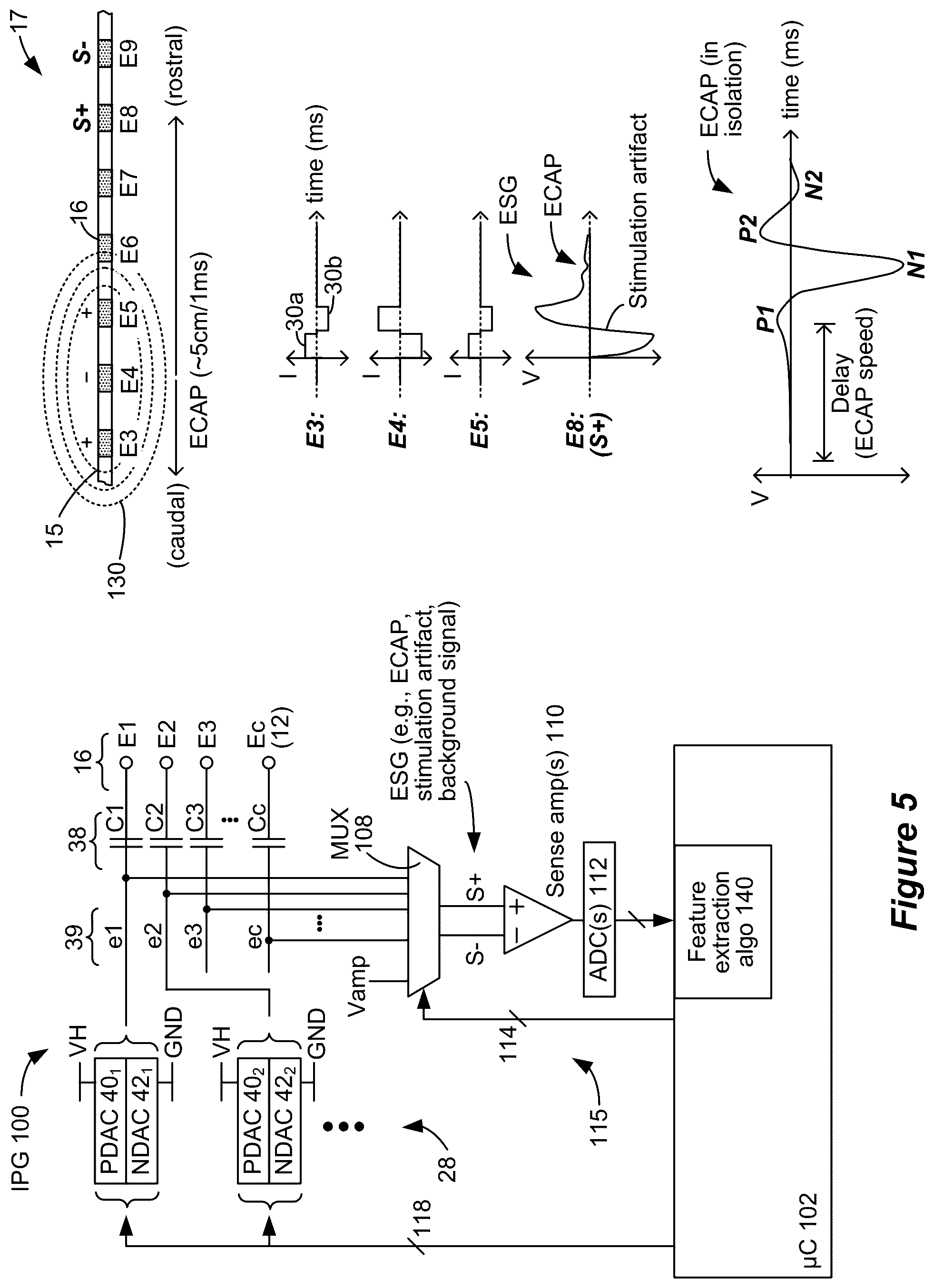 Patent US12599772 Figure 4 – Selection of sensing electrodes in a spinal cord stimulator system using sensed stimulation artifacts