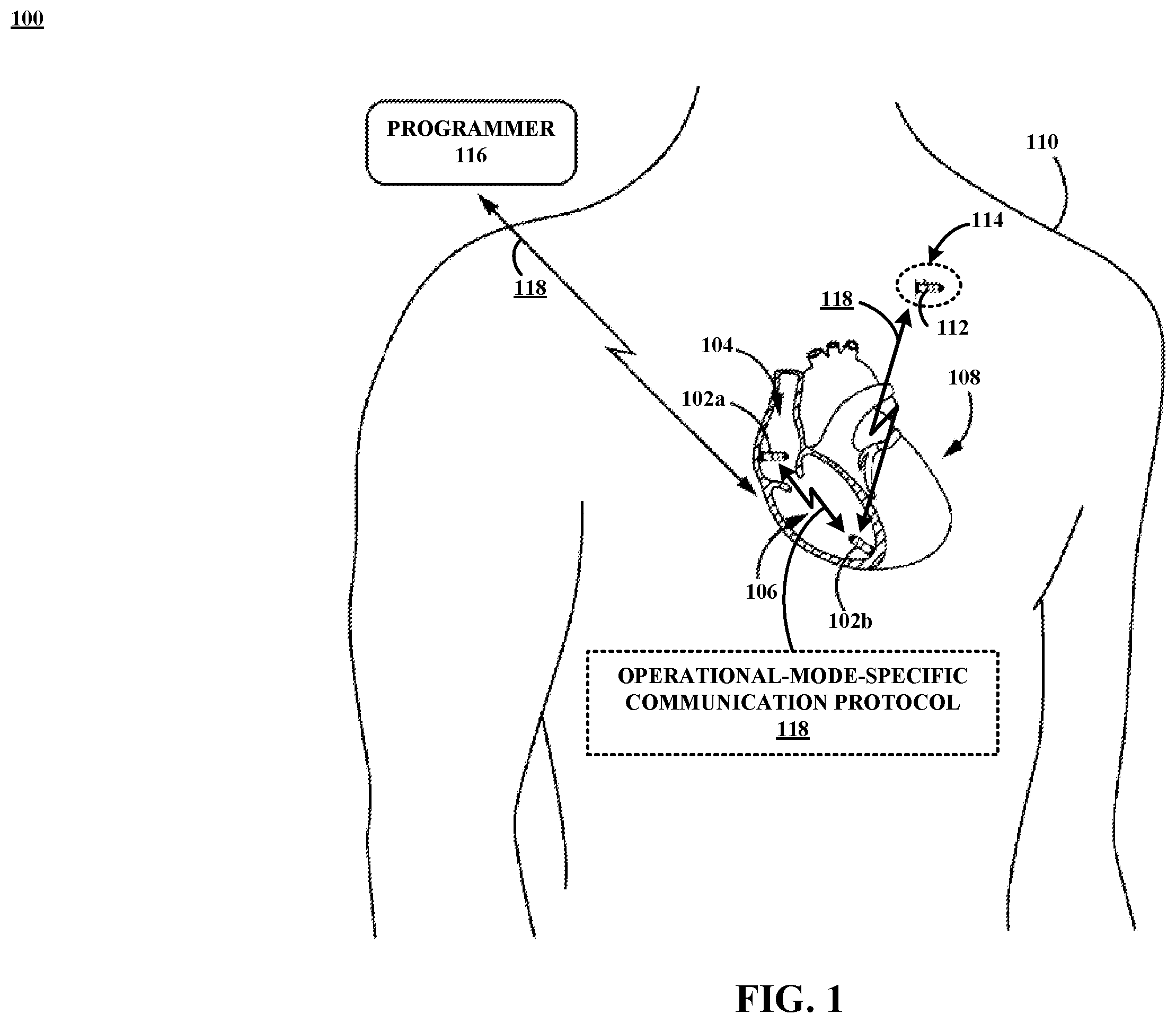 Patent US12599773 Figure 1 – Power management for implantable medical device systems