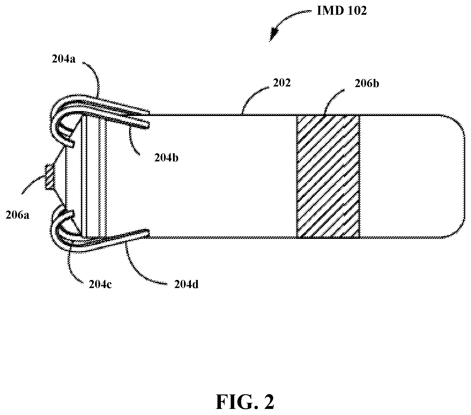 Patent US12599773 Figure 2 – Power management for implantable medical device systems