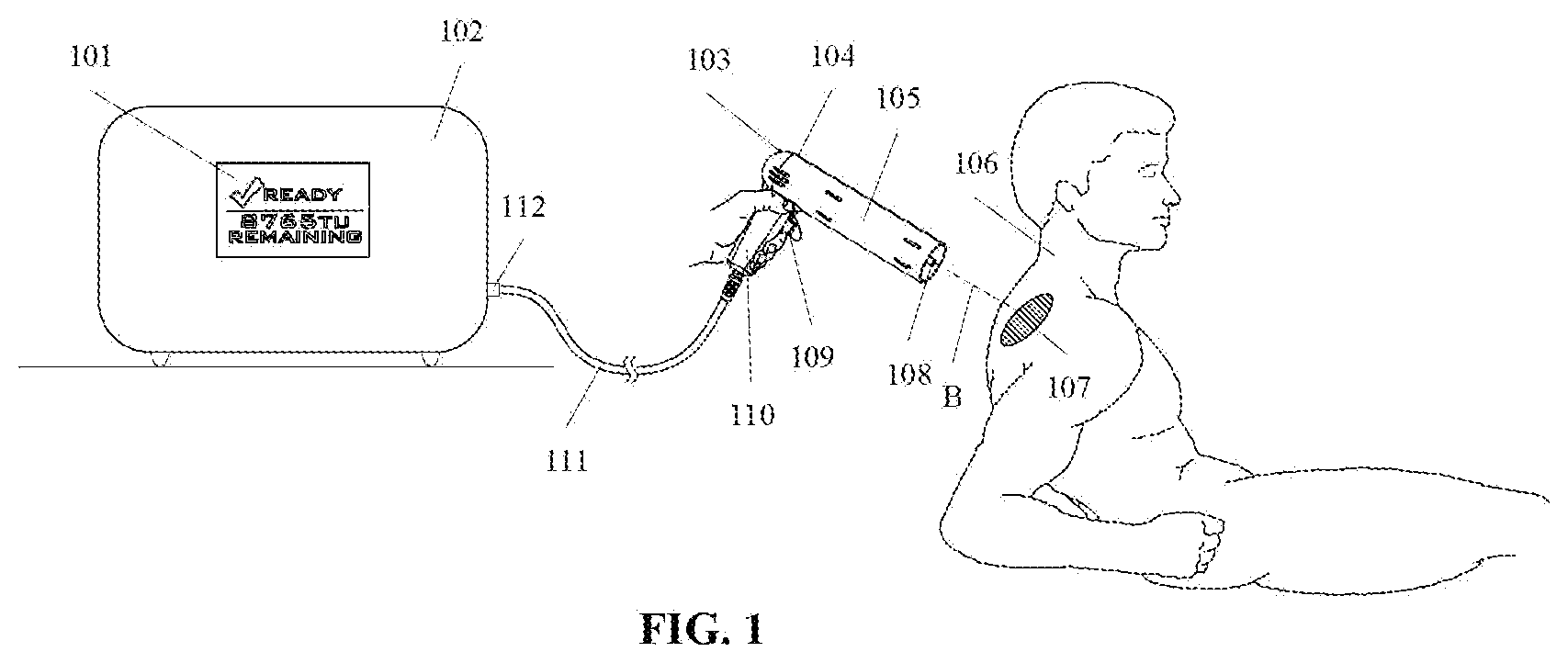 Patent US12599775 Figure 1 – Pulsed radio frequency therapy system, apparatus and method for using same