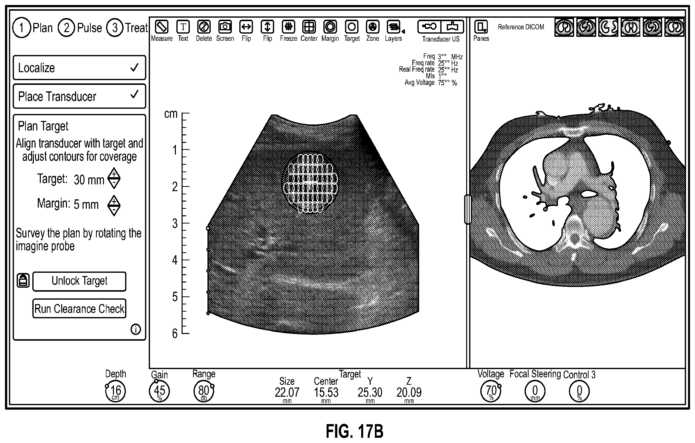 Patent US12599784 Figure 18 – Histotripsy systems and methods