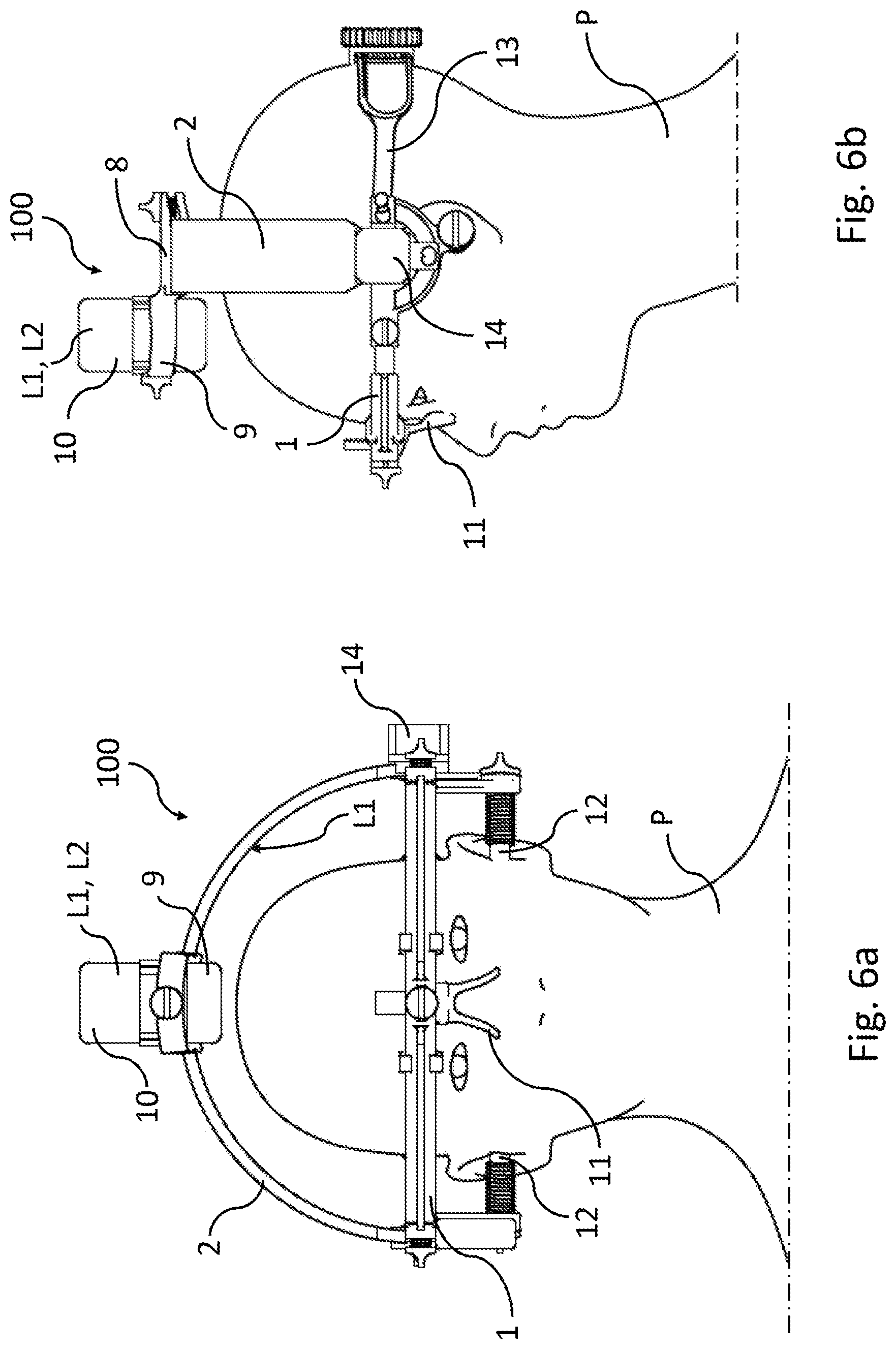 Patent US12599785 Figure 4 – Stereotactic device wearable by a patient for low-intensity focused-ultrasound neuromodulation