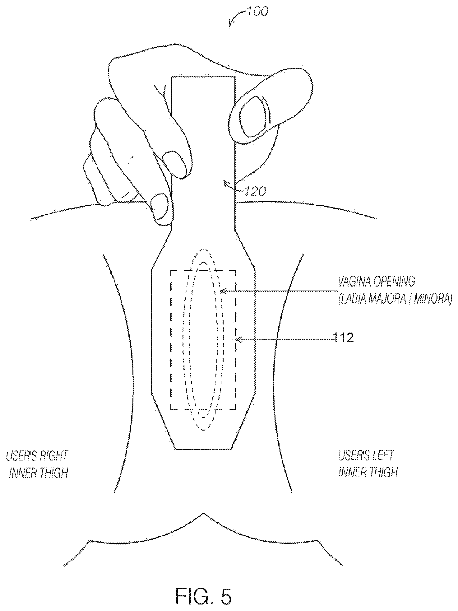 Patent US12599786 Figure 5 – Ultrasound device with attachable components